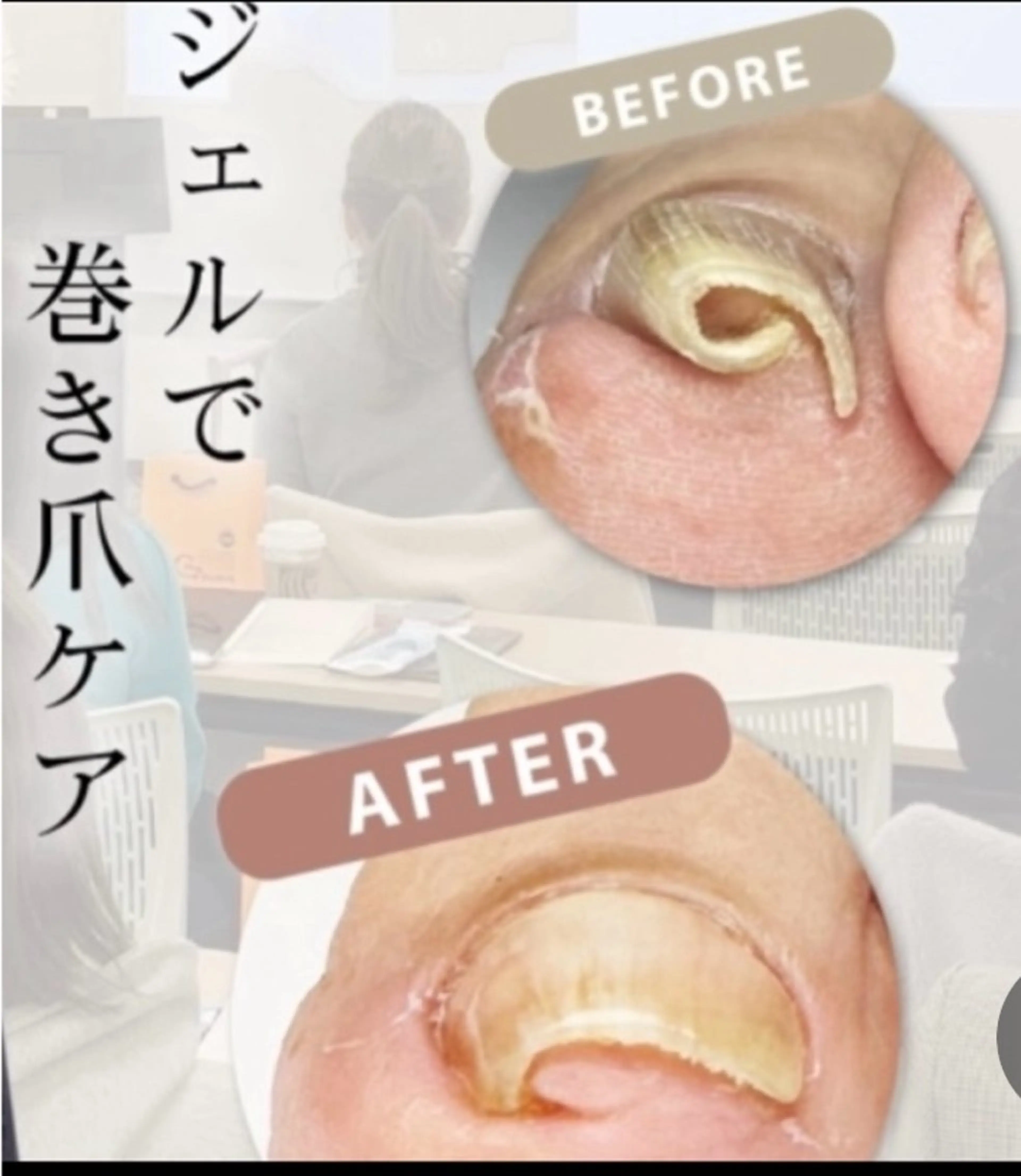 ネイル フットネイル NAIL ENVYのネイルデザイン
