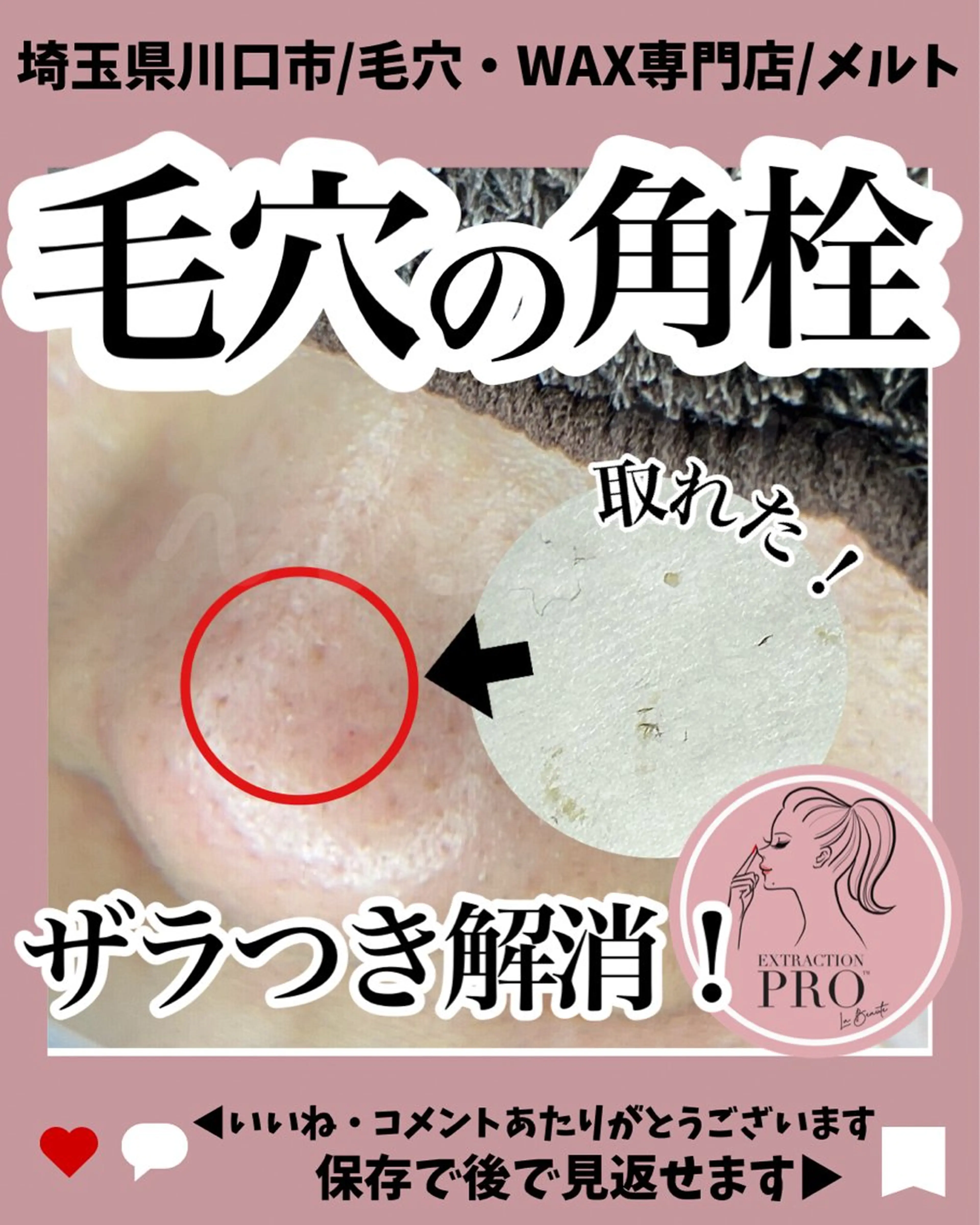 エステ melt まみのマツエク・マツパデザイン