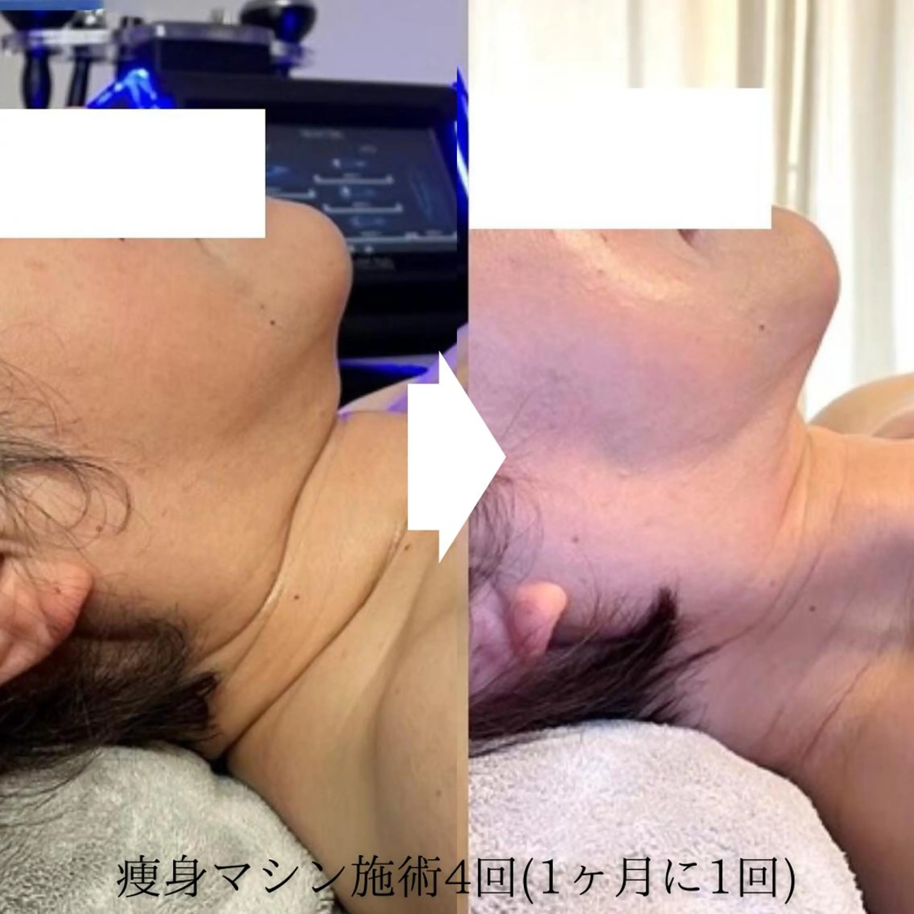 B-st. セルフエステ 下北沢のエステ・リラクイメージ