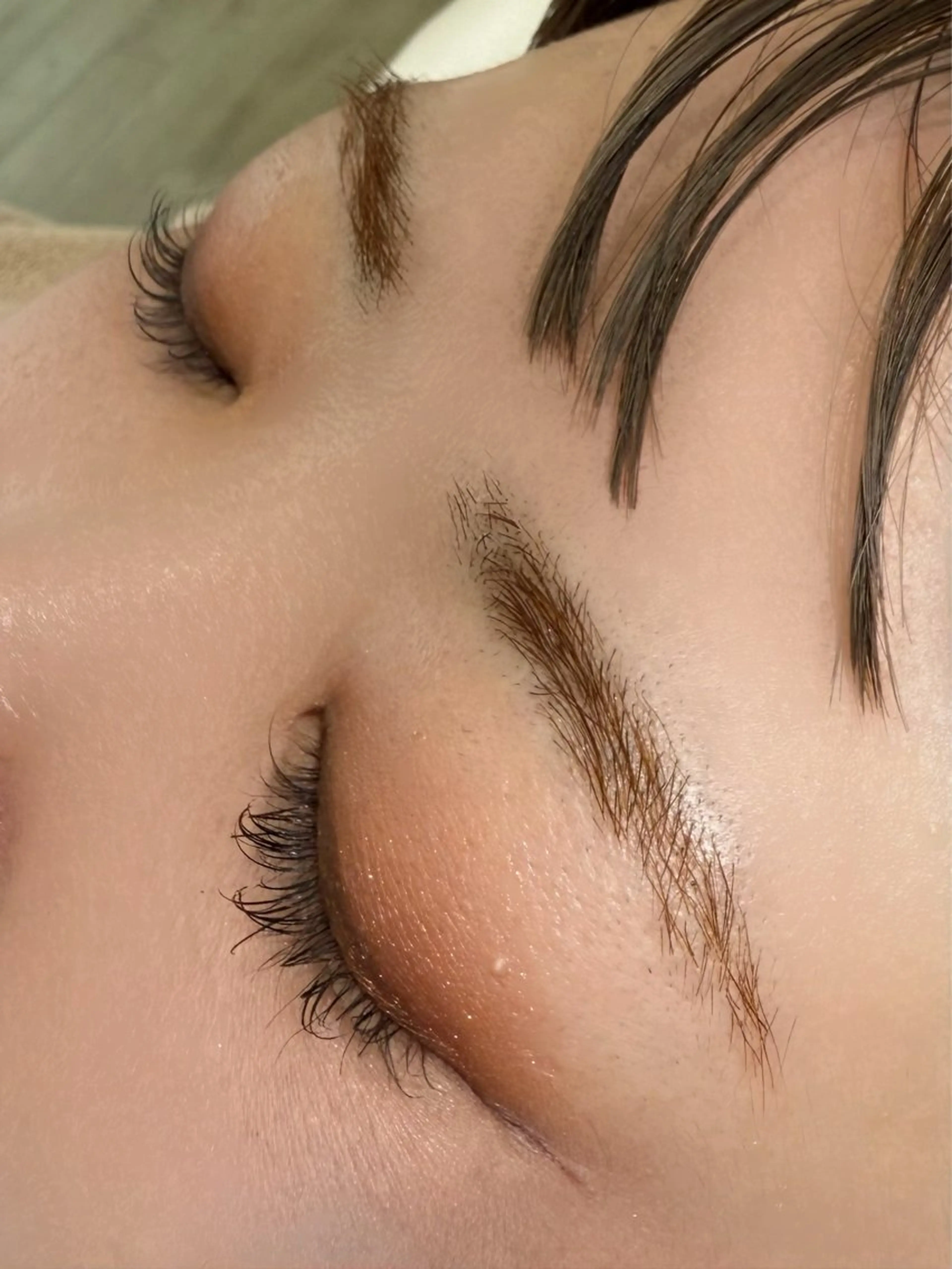 眉毛脱色の写真