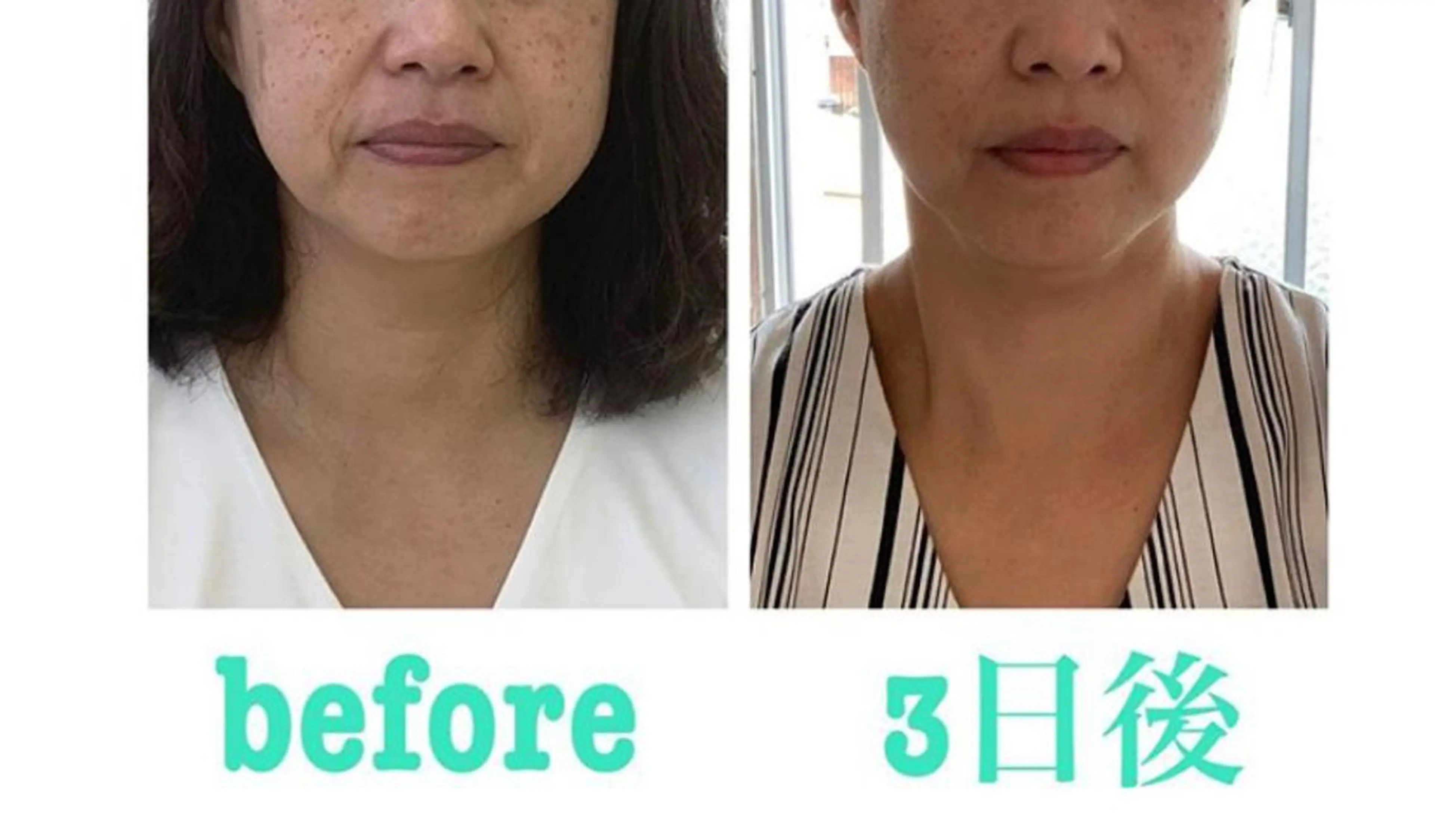 エステ リラク 小顔と ヘッドスパのお店のエステ・リラクイメージ