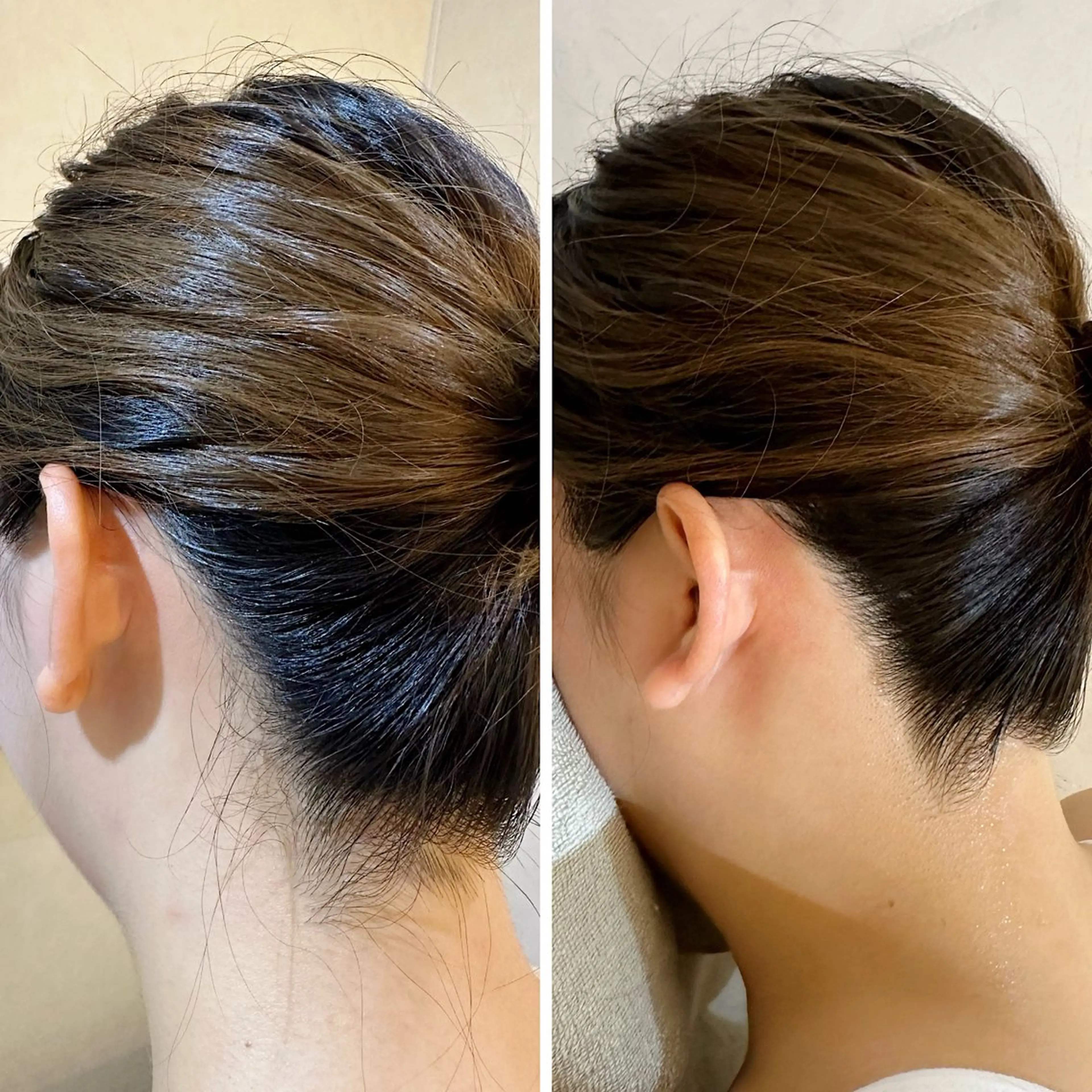 脱毛 うなじ脱毛/美肌脱毛 LABELのエステ・リラクイメージ