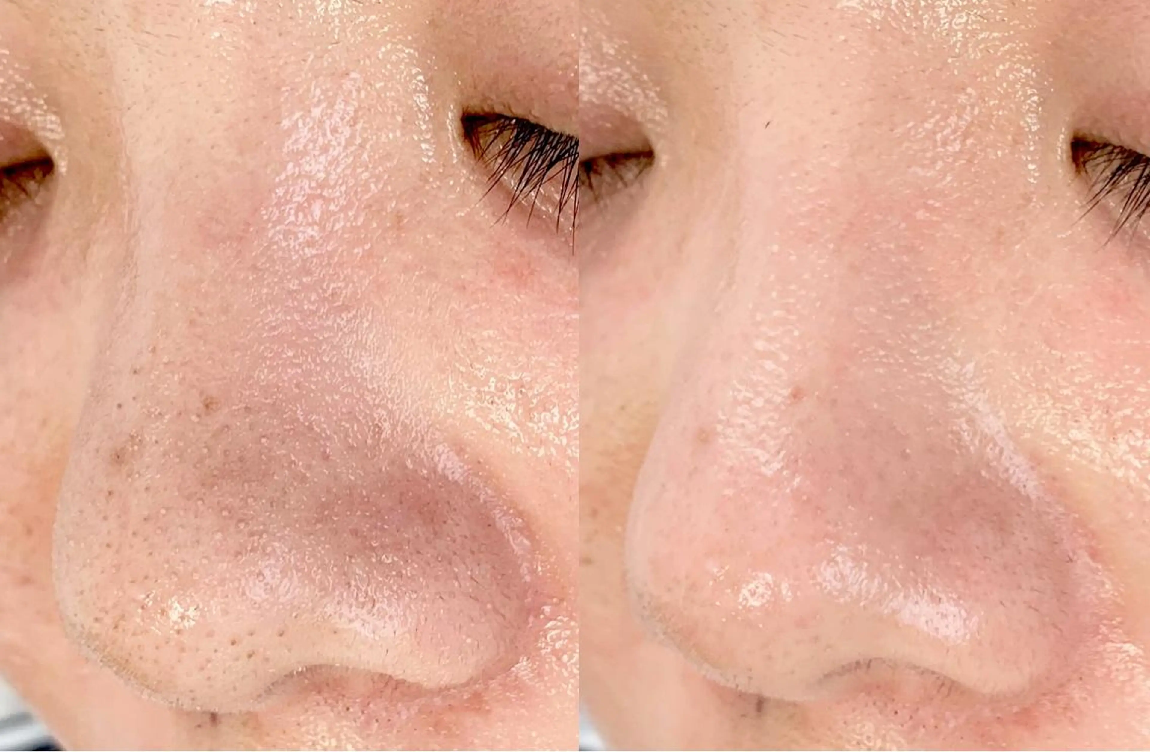 メンズ エステ salonLADYSTYLE所属・稲嶺 美華のエステ・リラクイメージ