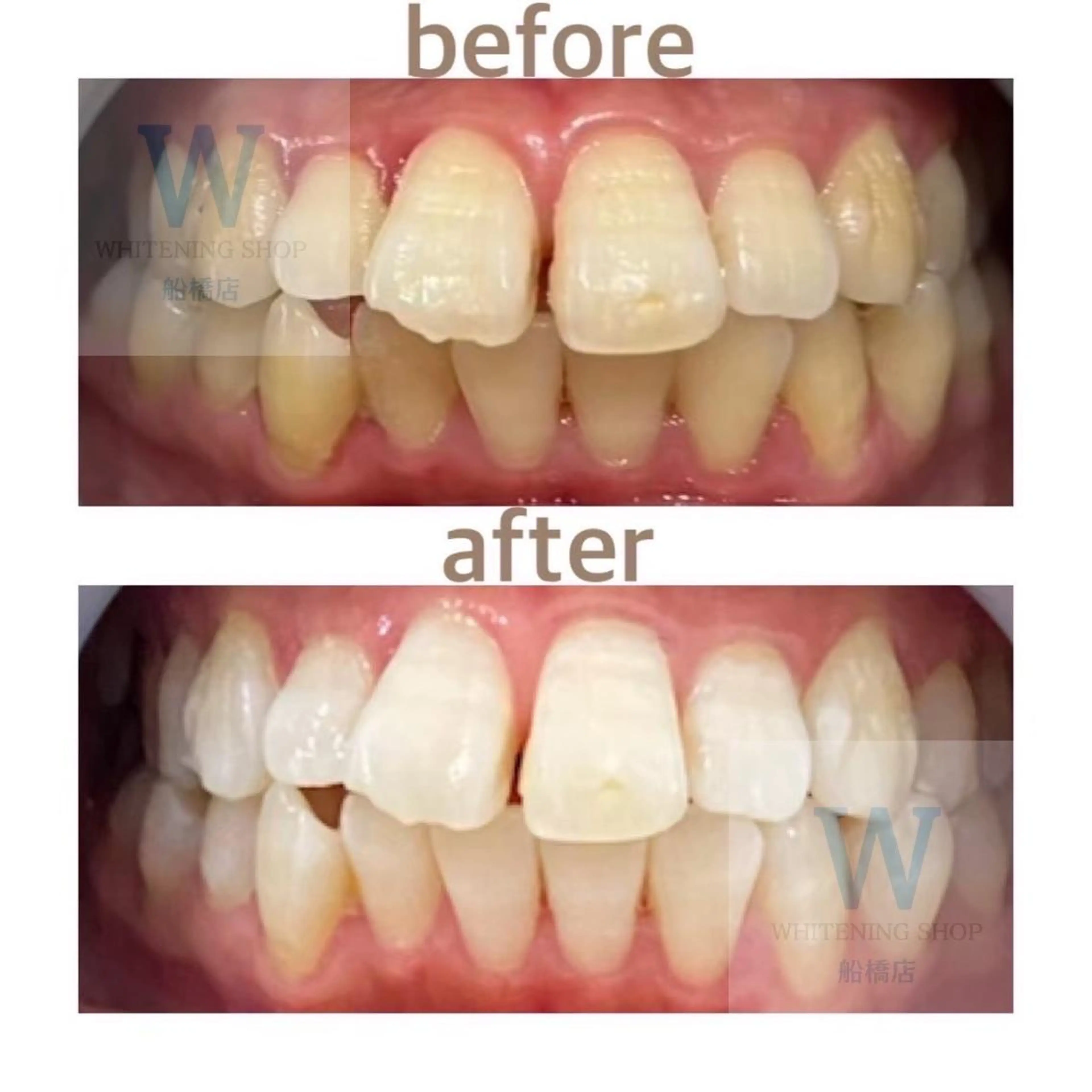 エステ リラク ホワイトニング ショップ船橋店🦷のエステ・リラクイメージ