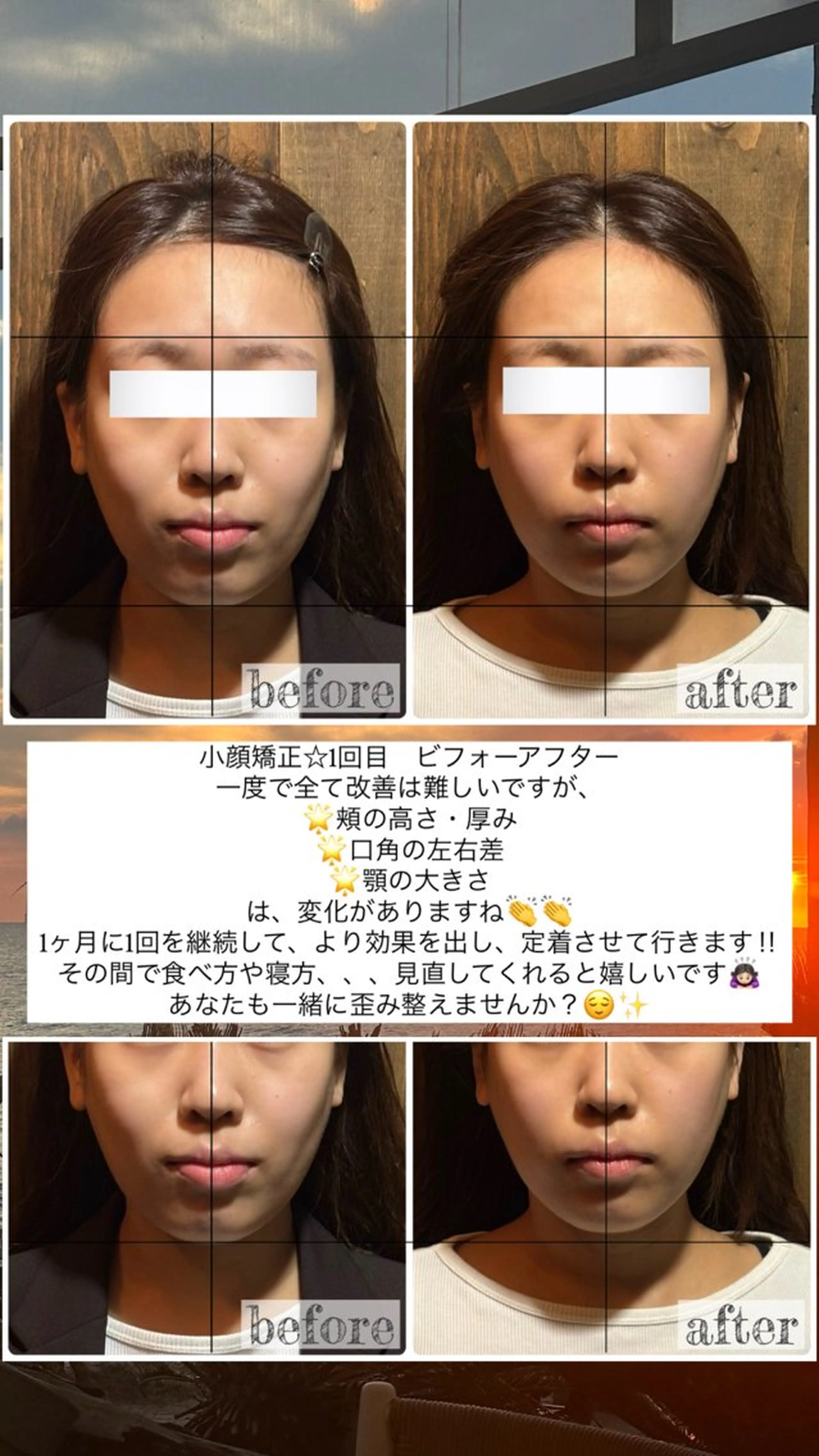 エステ リラク 💎後悔させない小顔 矯正💎イトヤマ🌱のエステ・リラクイメージ