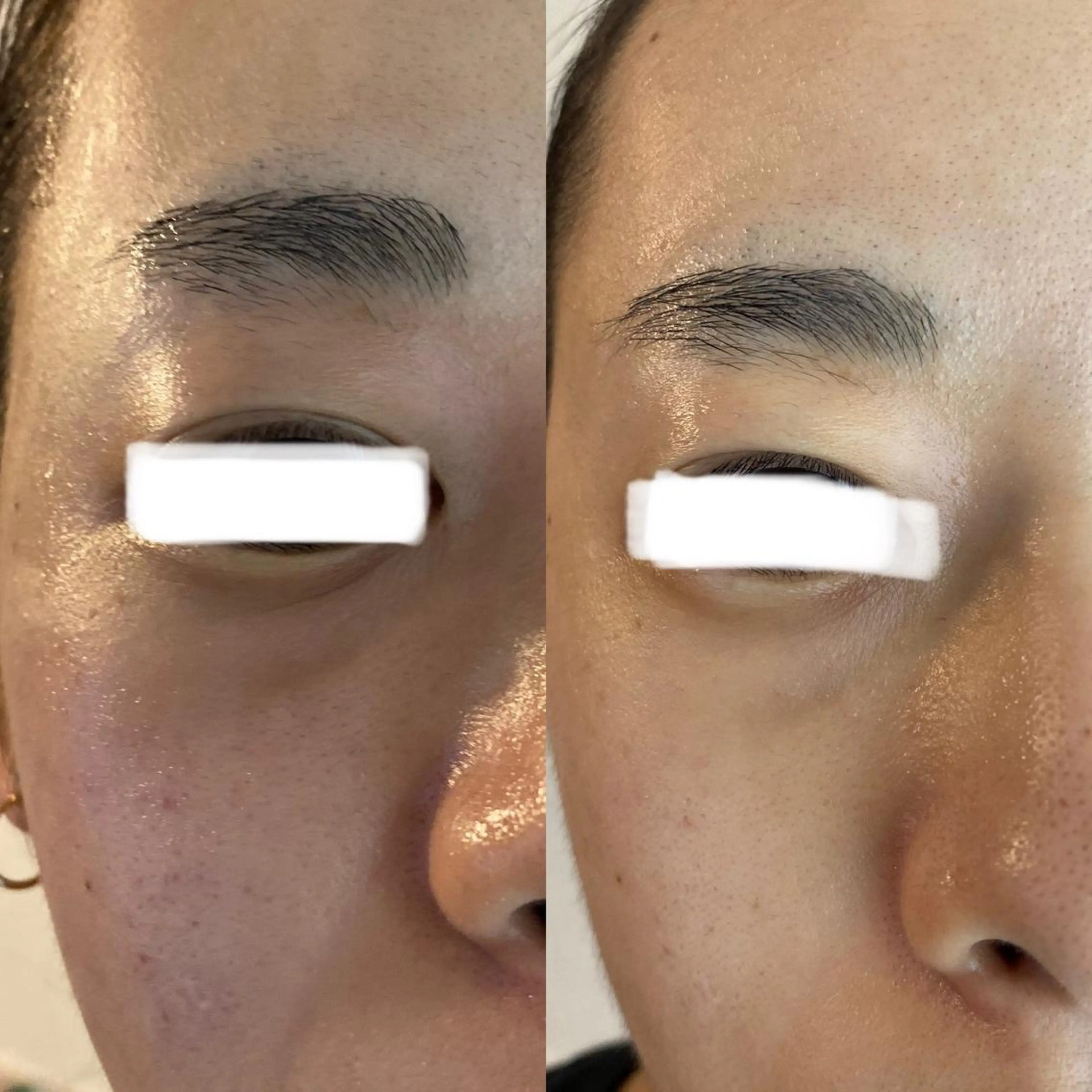 Meetite 小林のエステ・リラクイメージ