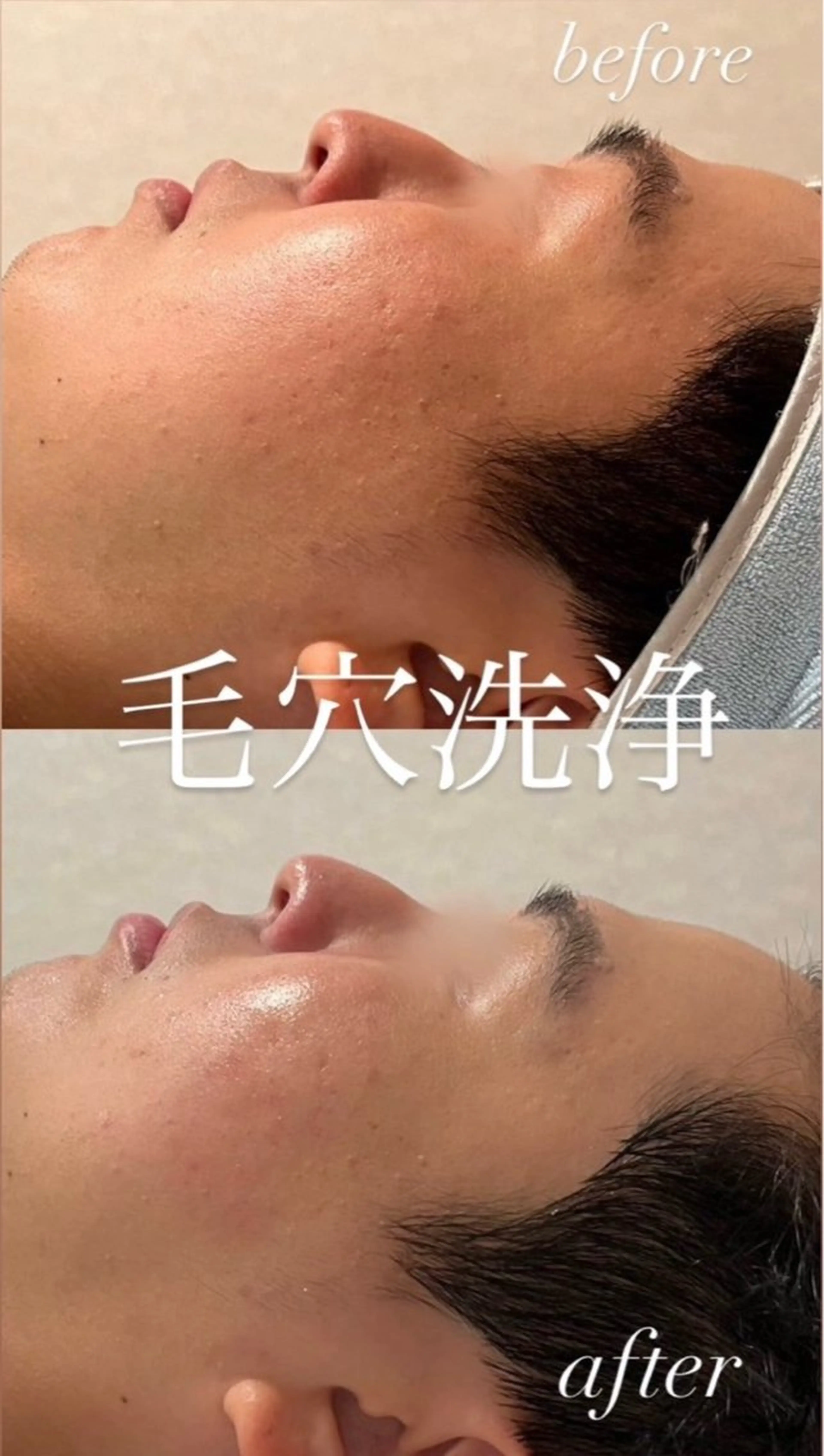 エステ 🌼SALON Lazuli久留米のエステ・リラクイメージ