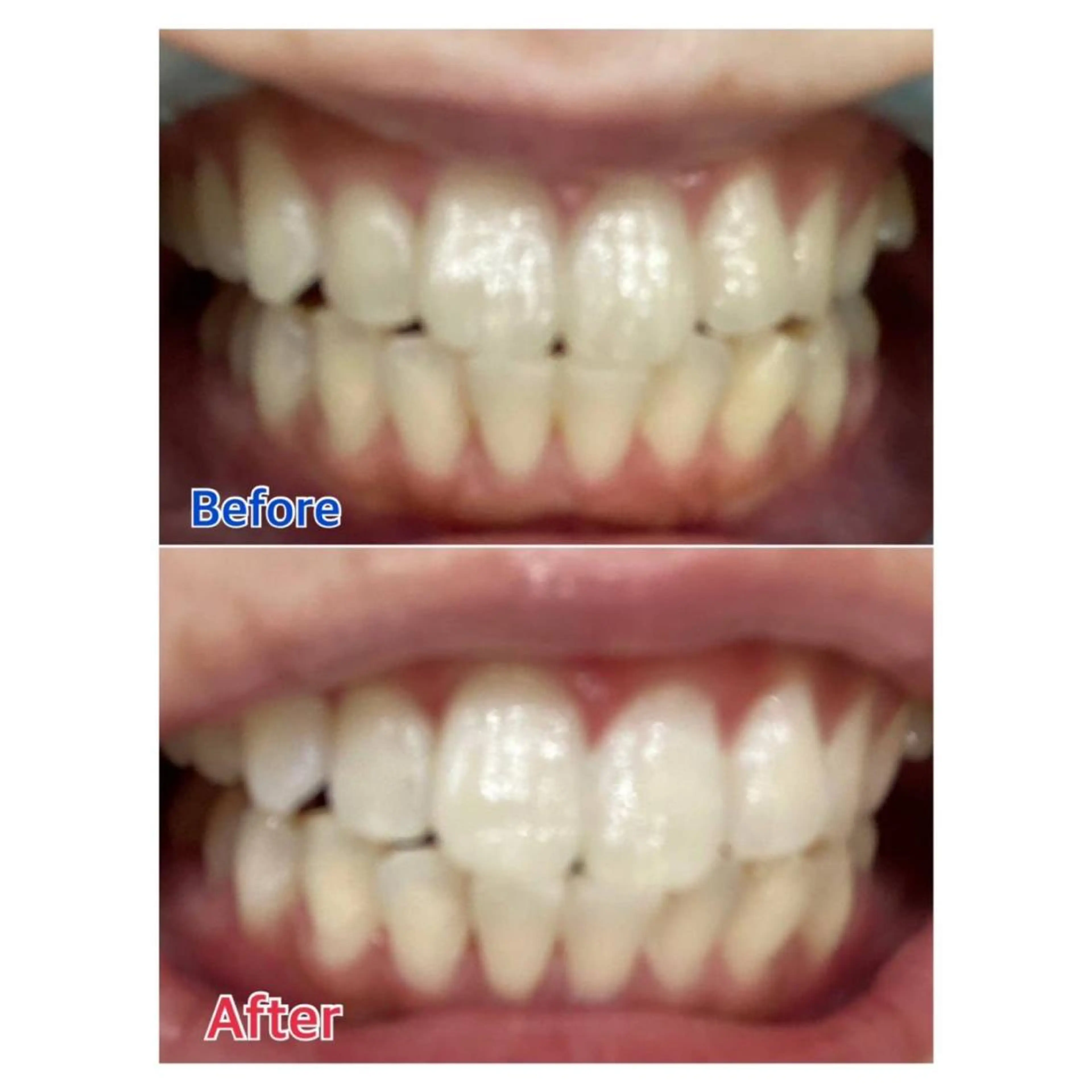 MBEAUTYSALON 千葉店・京成大久保所属・Melty 輝のその他イメージ