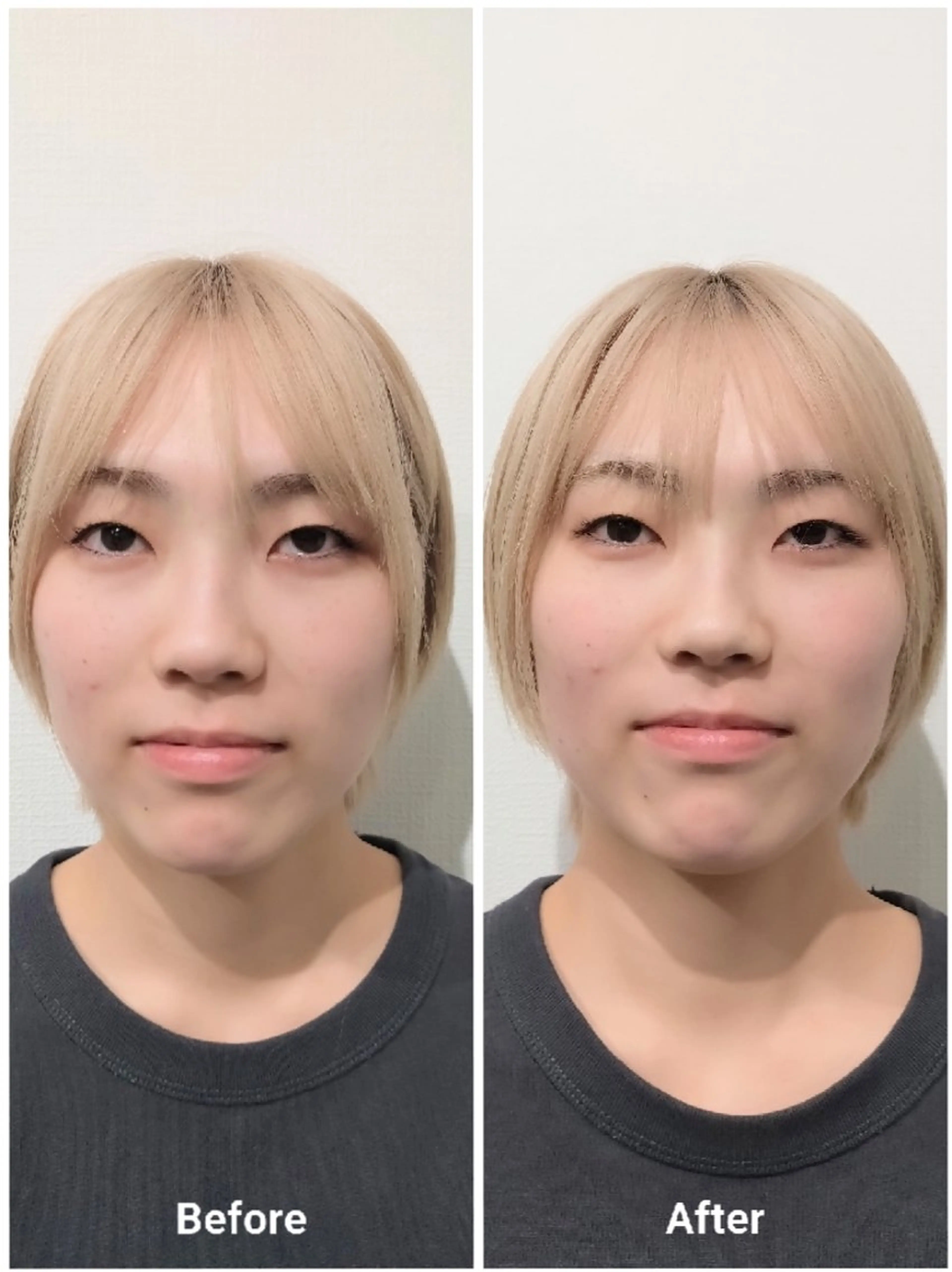 【平日限定】小顔矯正45分¥2,200-の写真