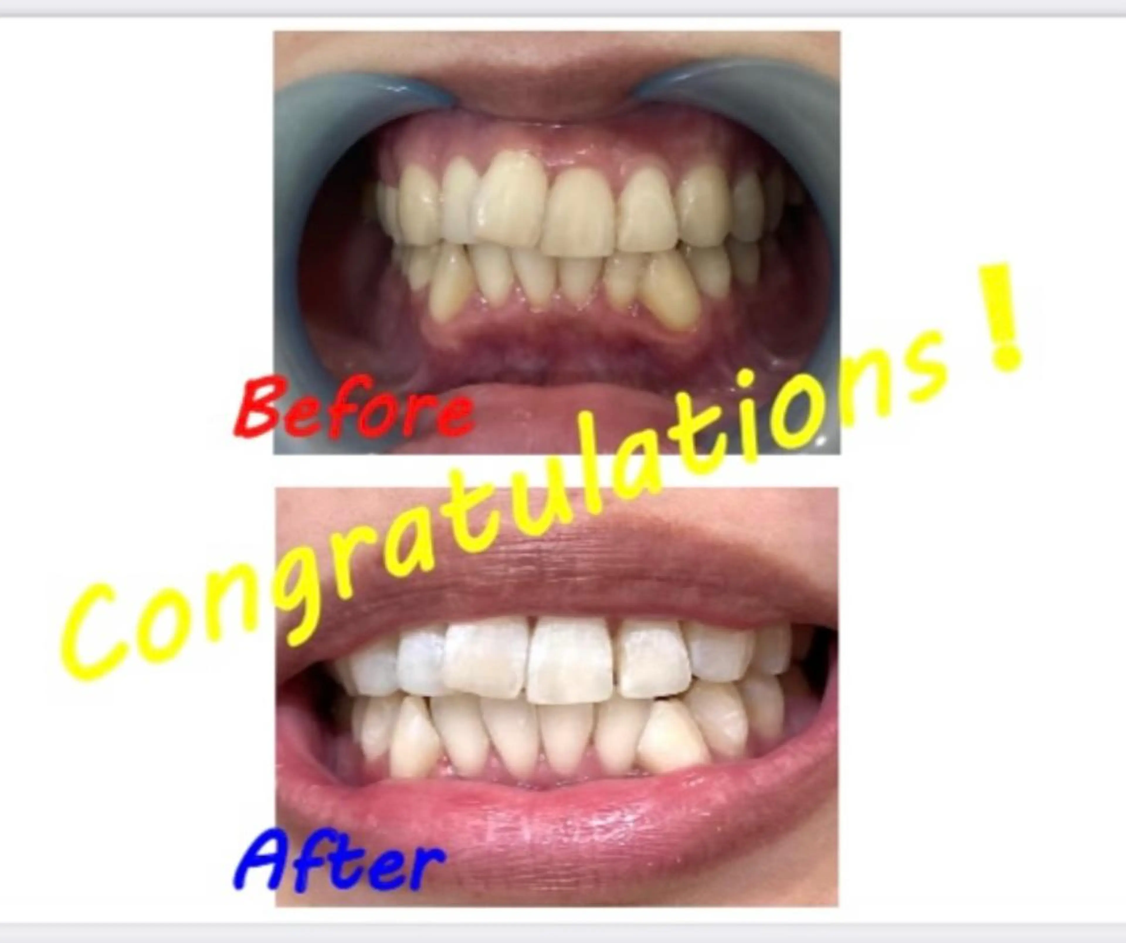 その他 セルフホワイトニングサロン　ラヴィアン所属・ホワイトニングサロン La vie enのその他イメージ