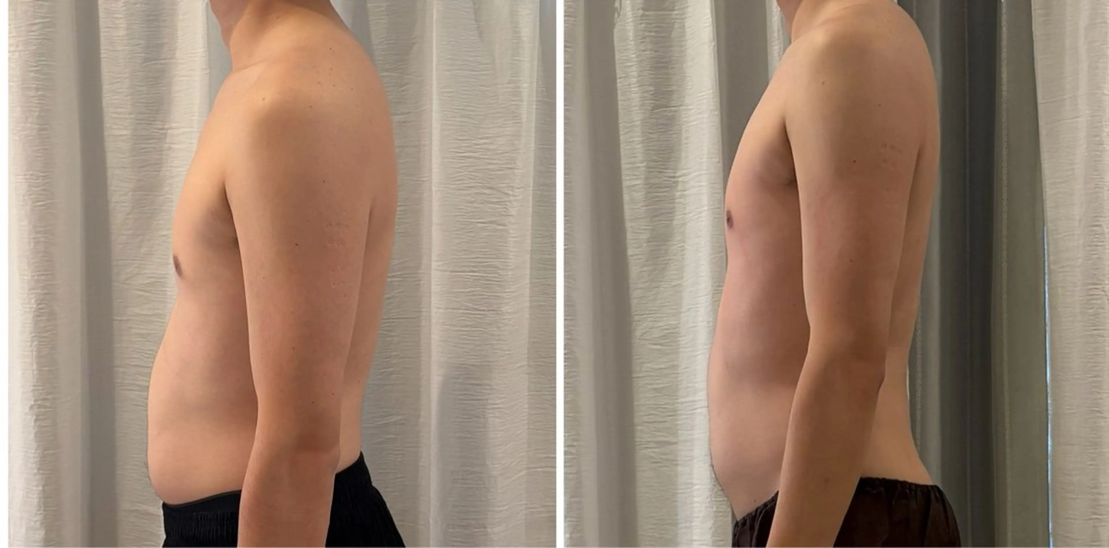 上半身痩身コルギ（カッピング、ホットストーン付き）の写真