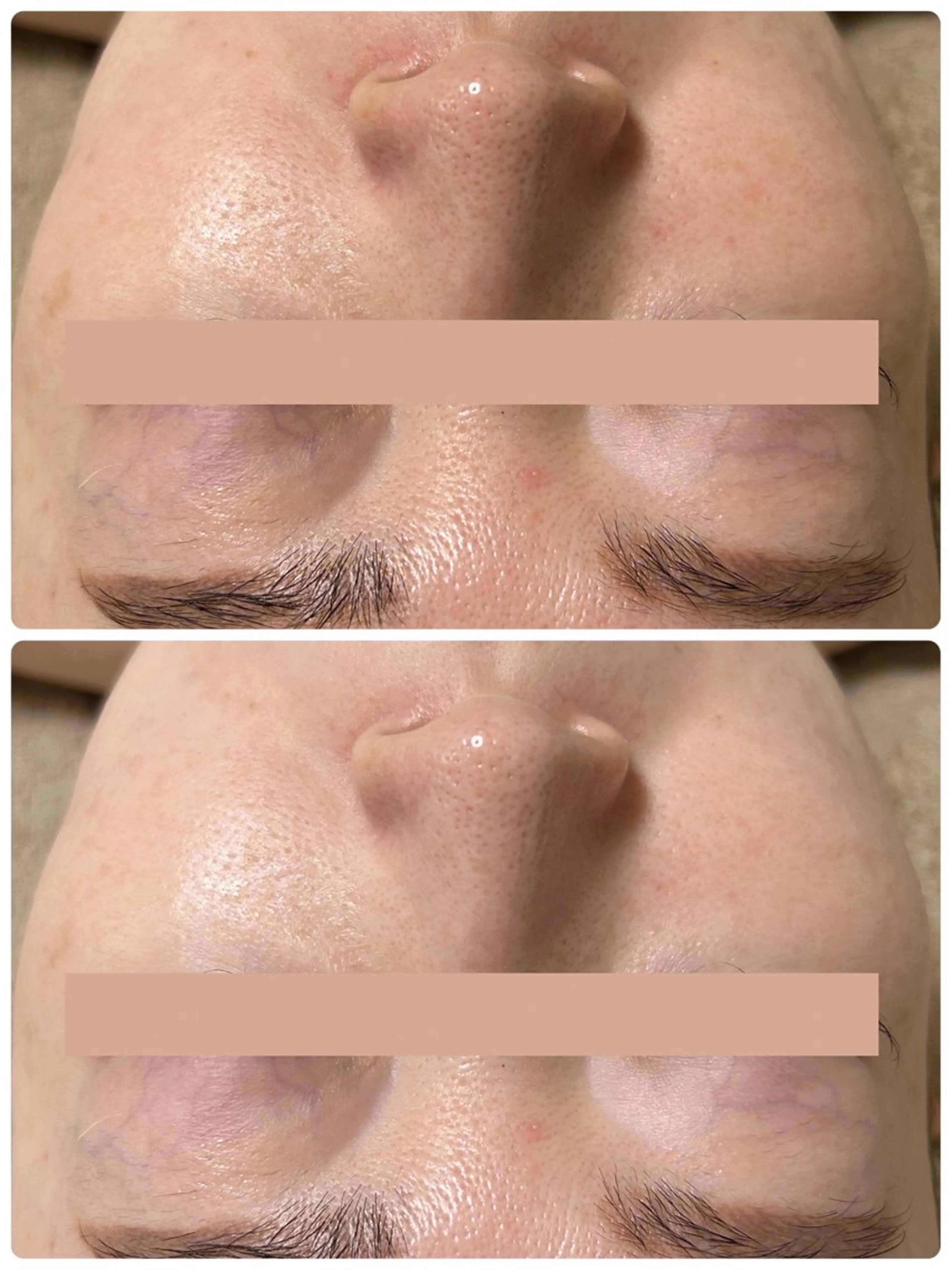 Beauty salon Wish所属・脱毛🌈肌質改善🌈 Wishのエステ・リラクイメージ