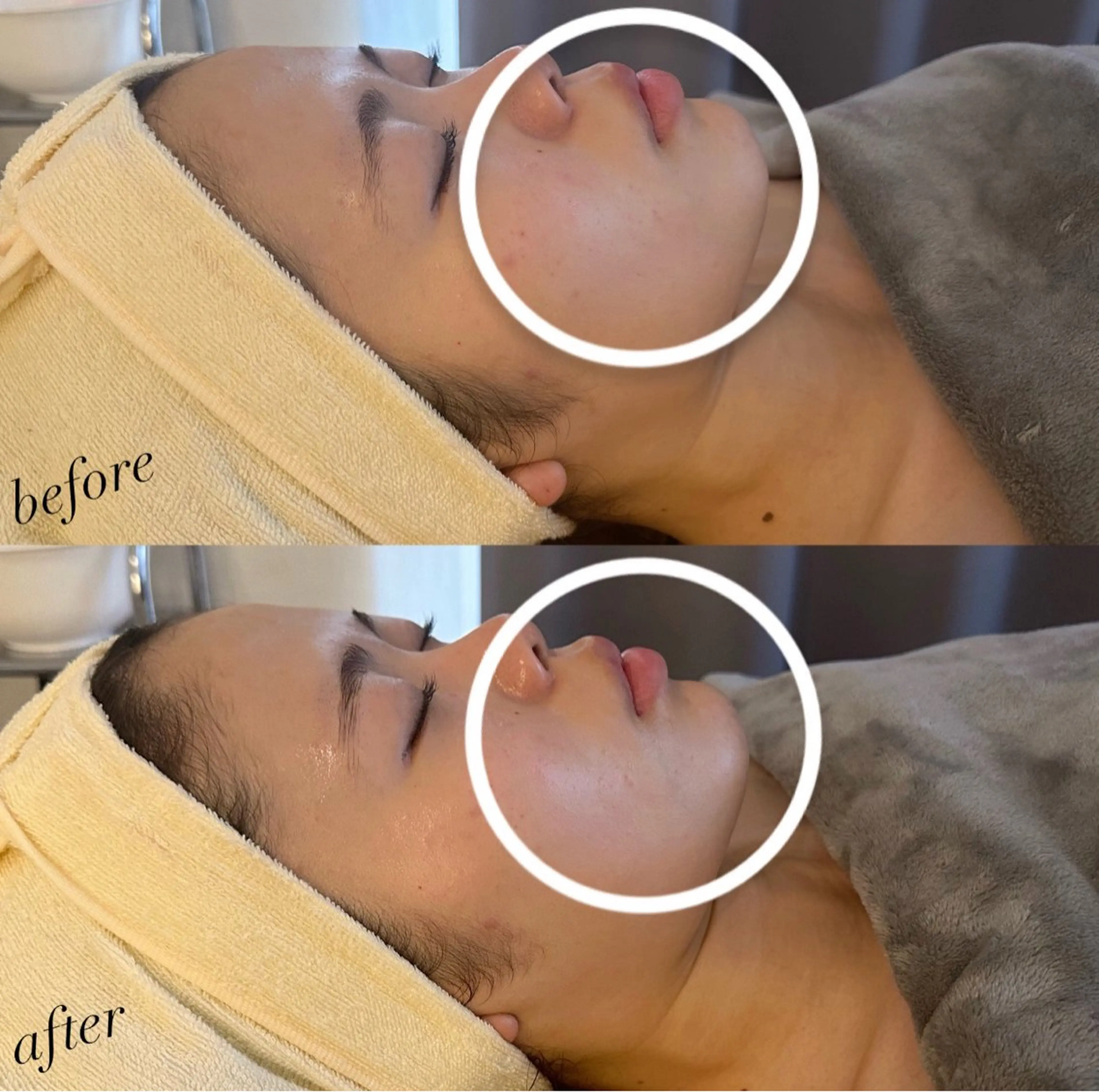 エステ うなじ脱毛/美肌脱毛 LABELのエステ・リラクイメージ