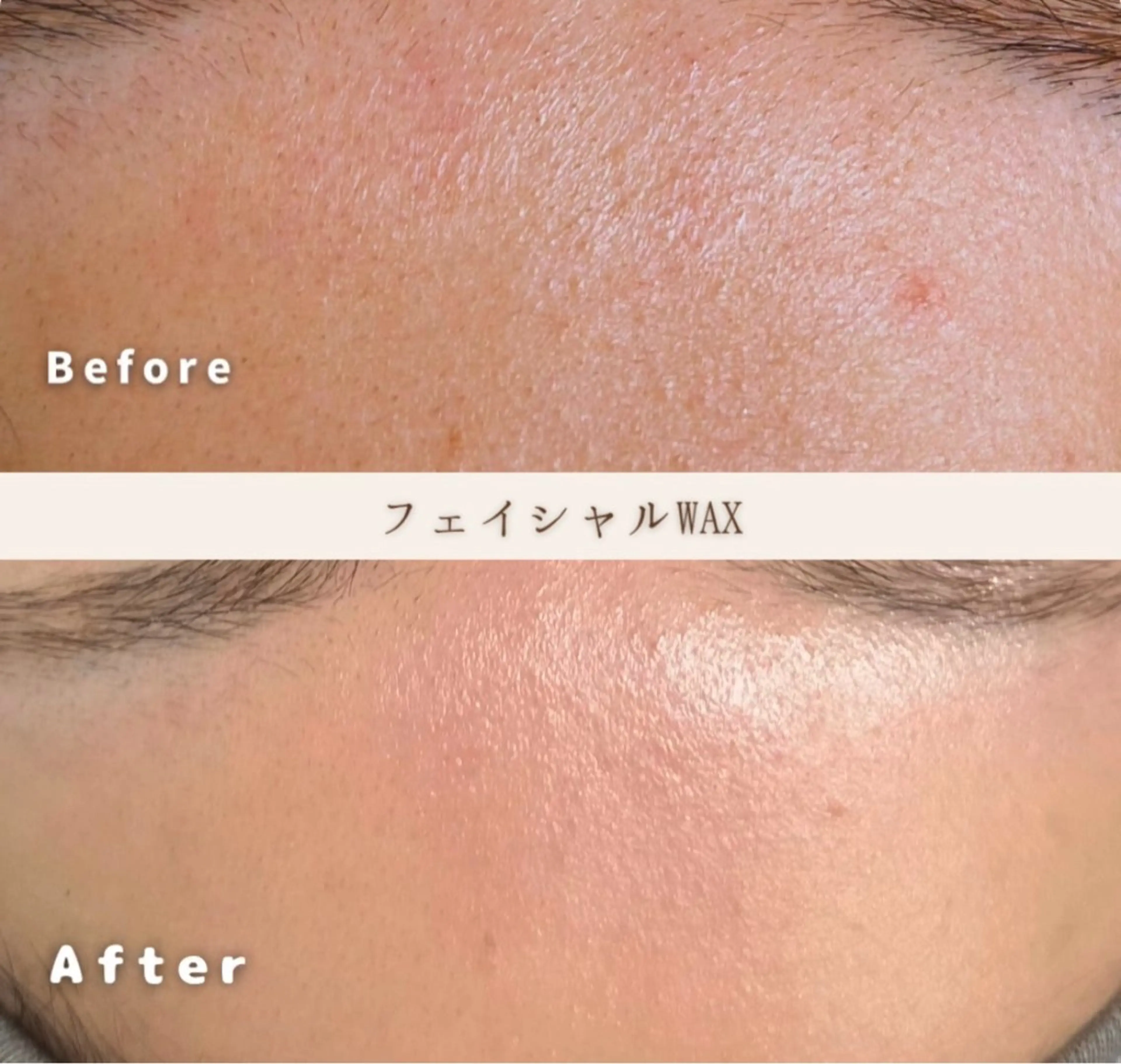 【フェイシャルWAX】モニター価格！の写真