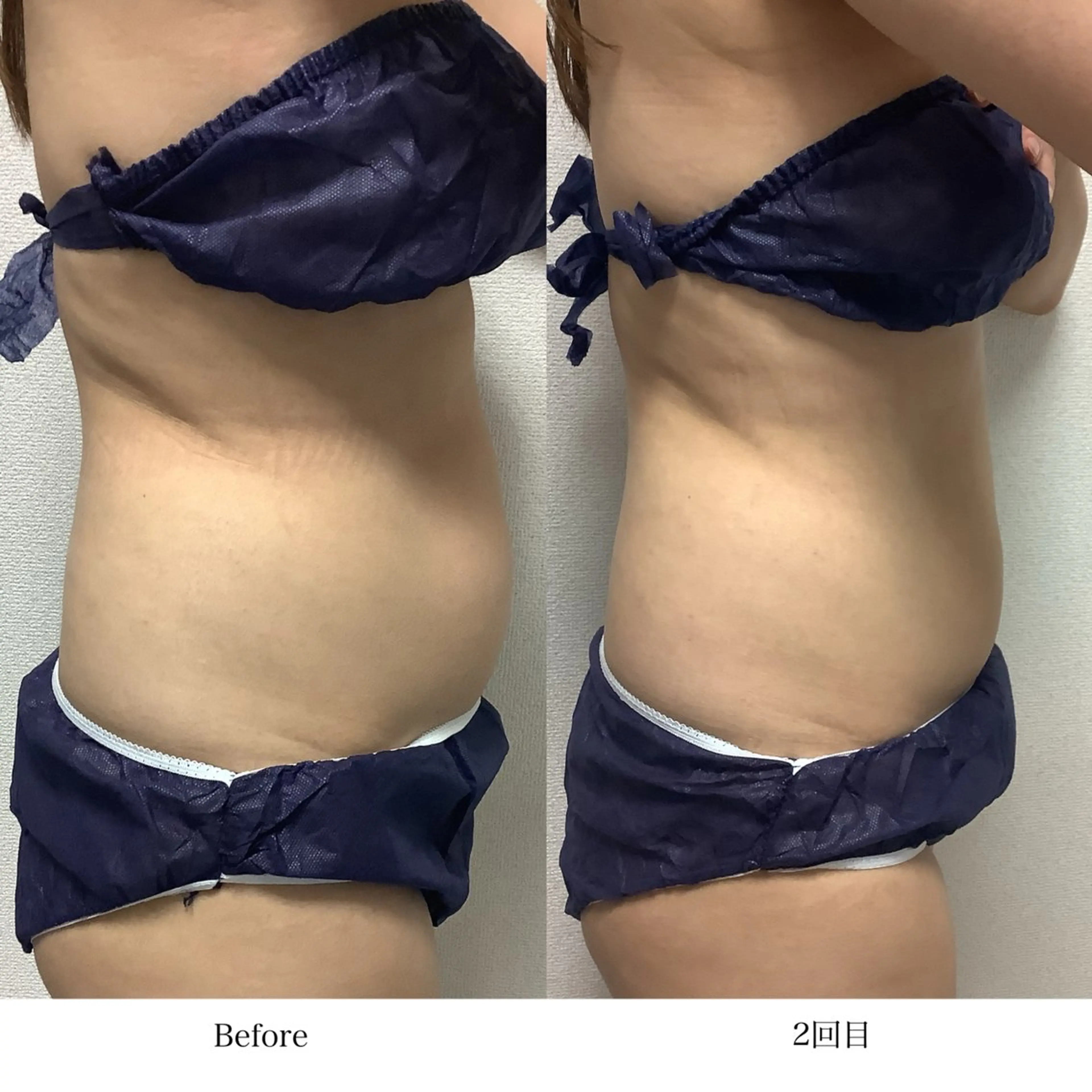 冷却専門店 SLARIのエステ・リラクイメージ