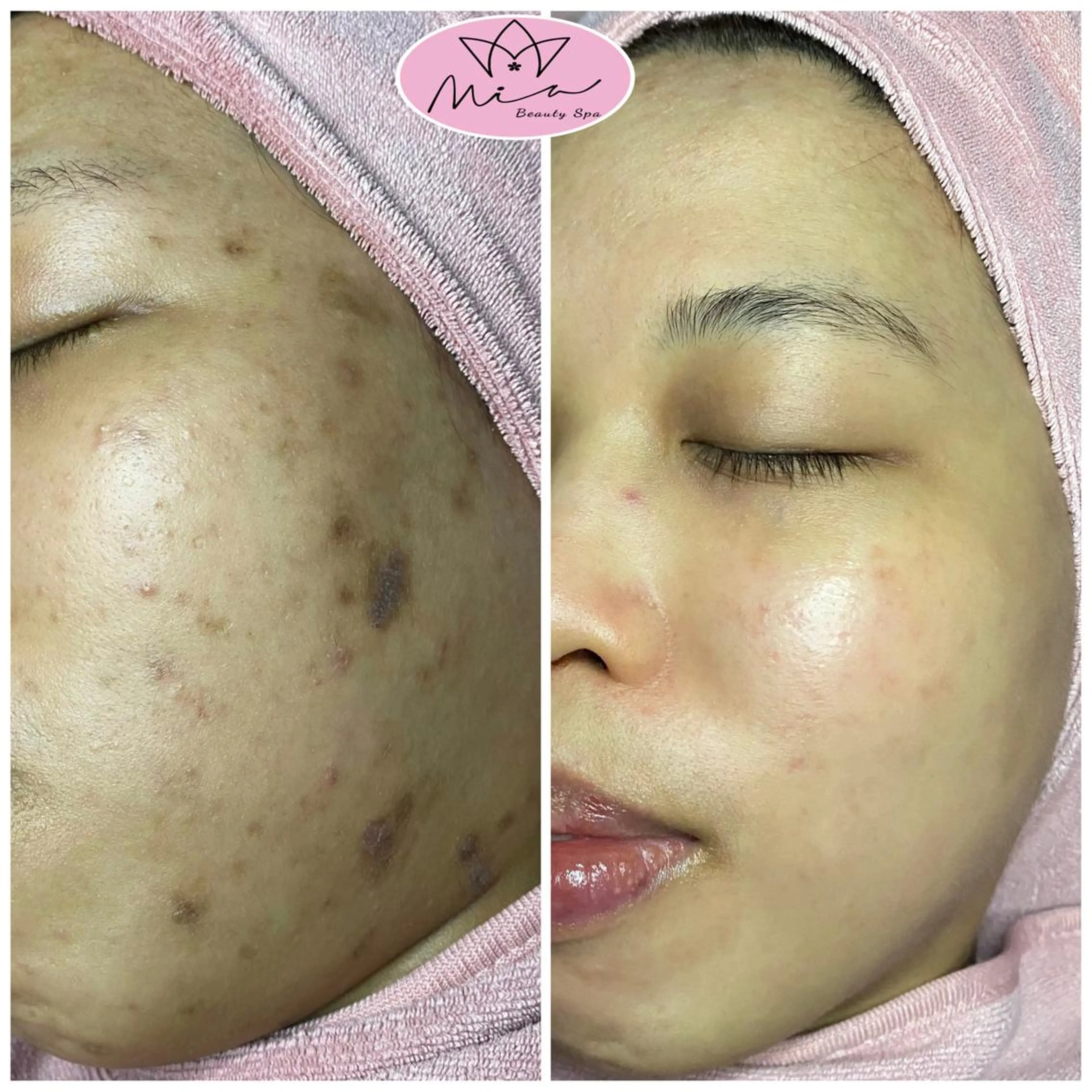 Mia beauty所属・MiA Beautyのエステ・リラクイメージ
