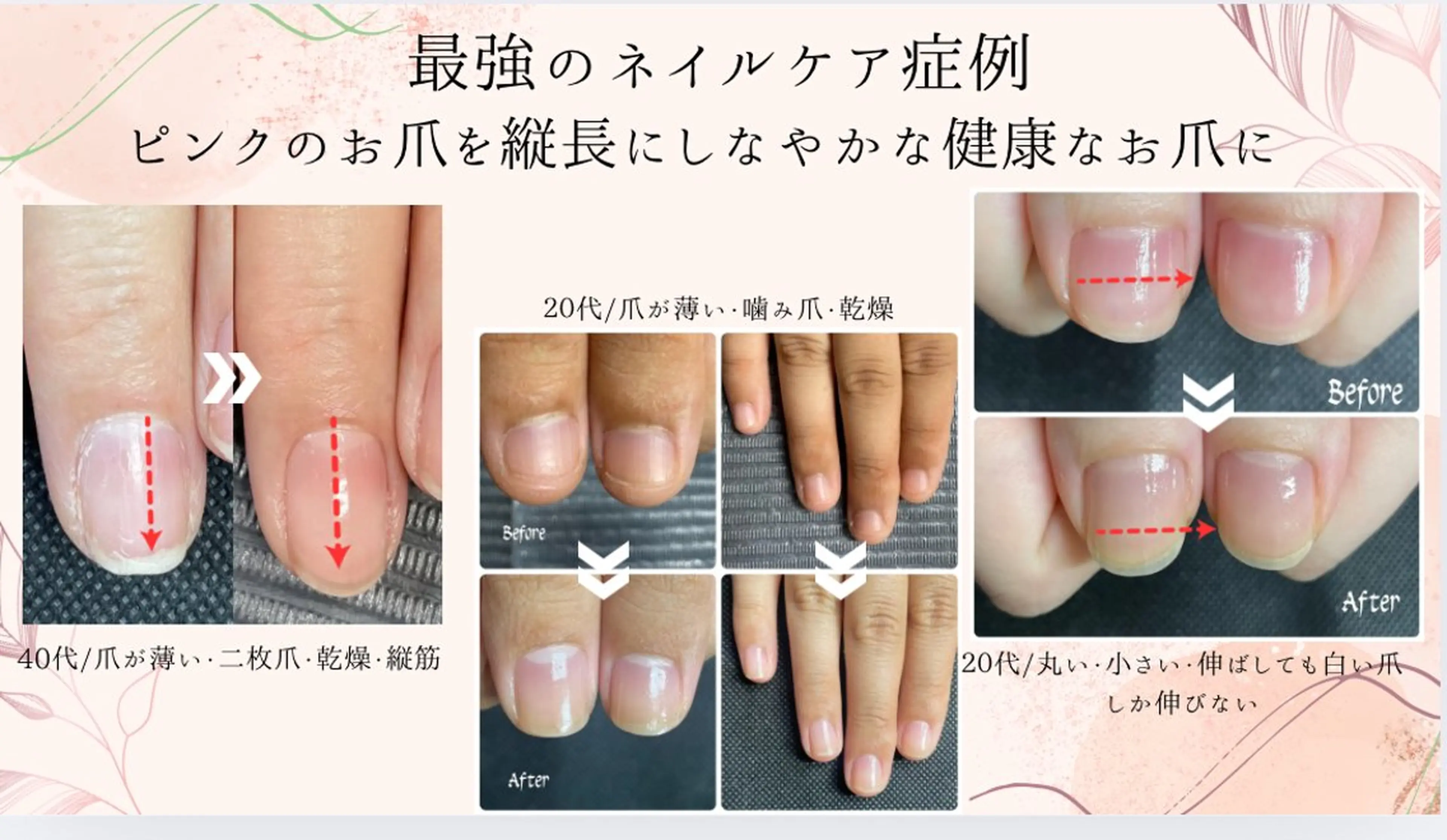 自爪育成　最強のネイルケアコースの写真