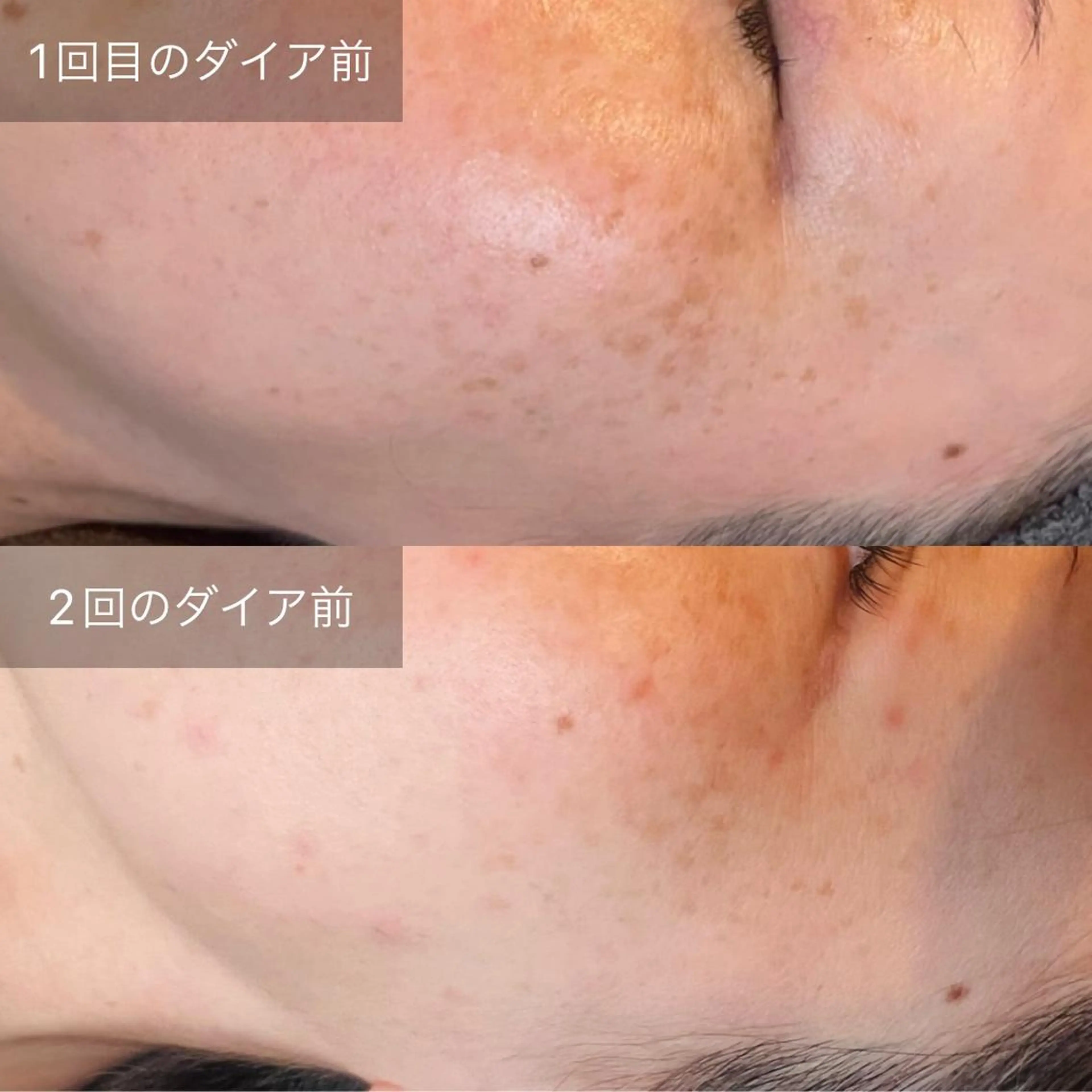 Belulu所属・安齋 都のネイルデザイン