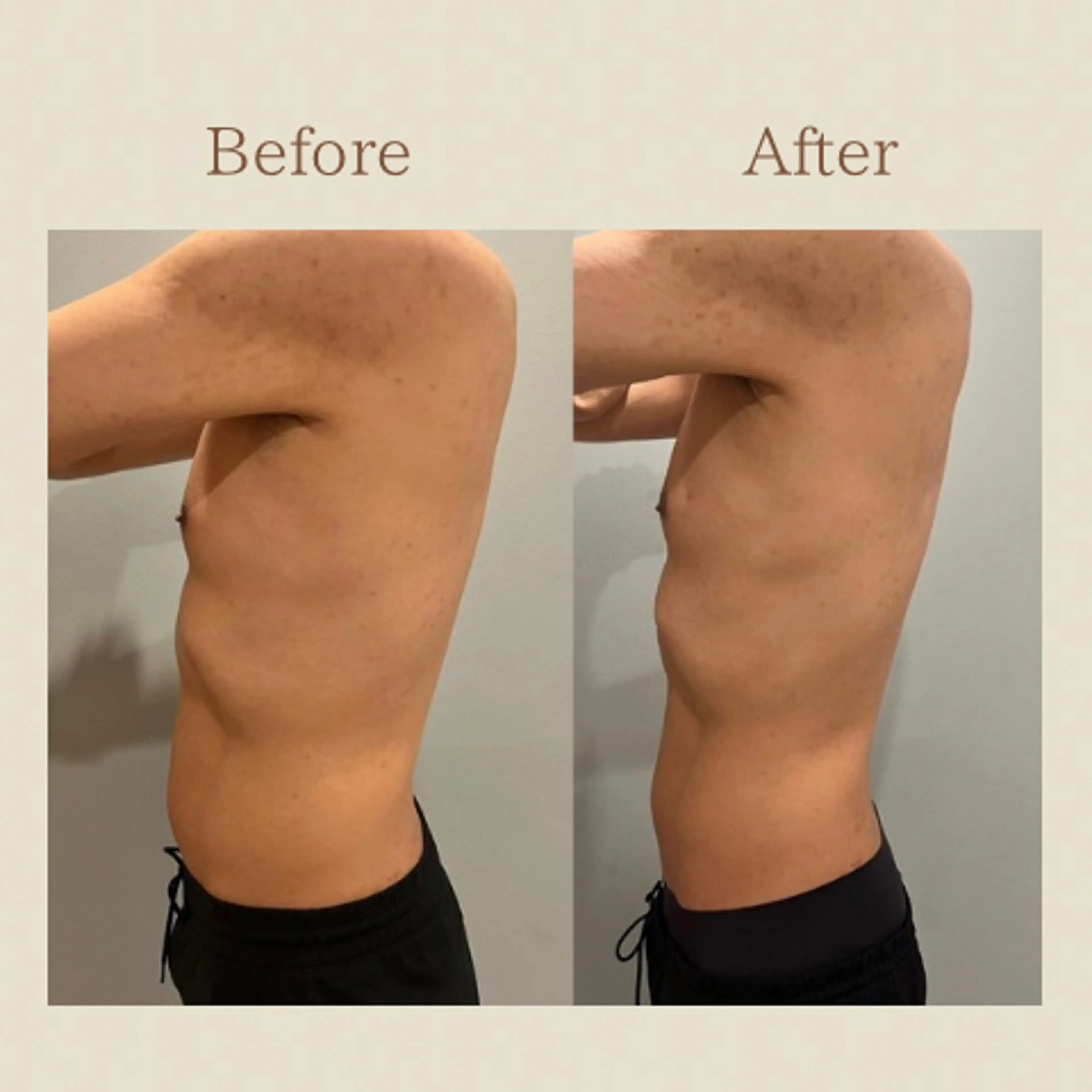 お腹痩せエステ Flat BELLY 恵比寿所属・【腸もみ/脂肪冷却】 お腹エステ/恵比寿のエステ・リラクイメージ