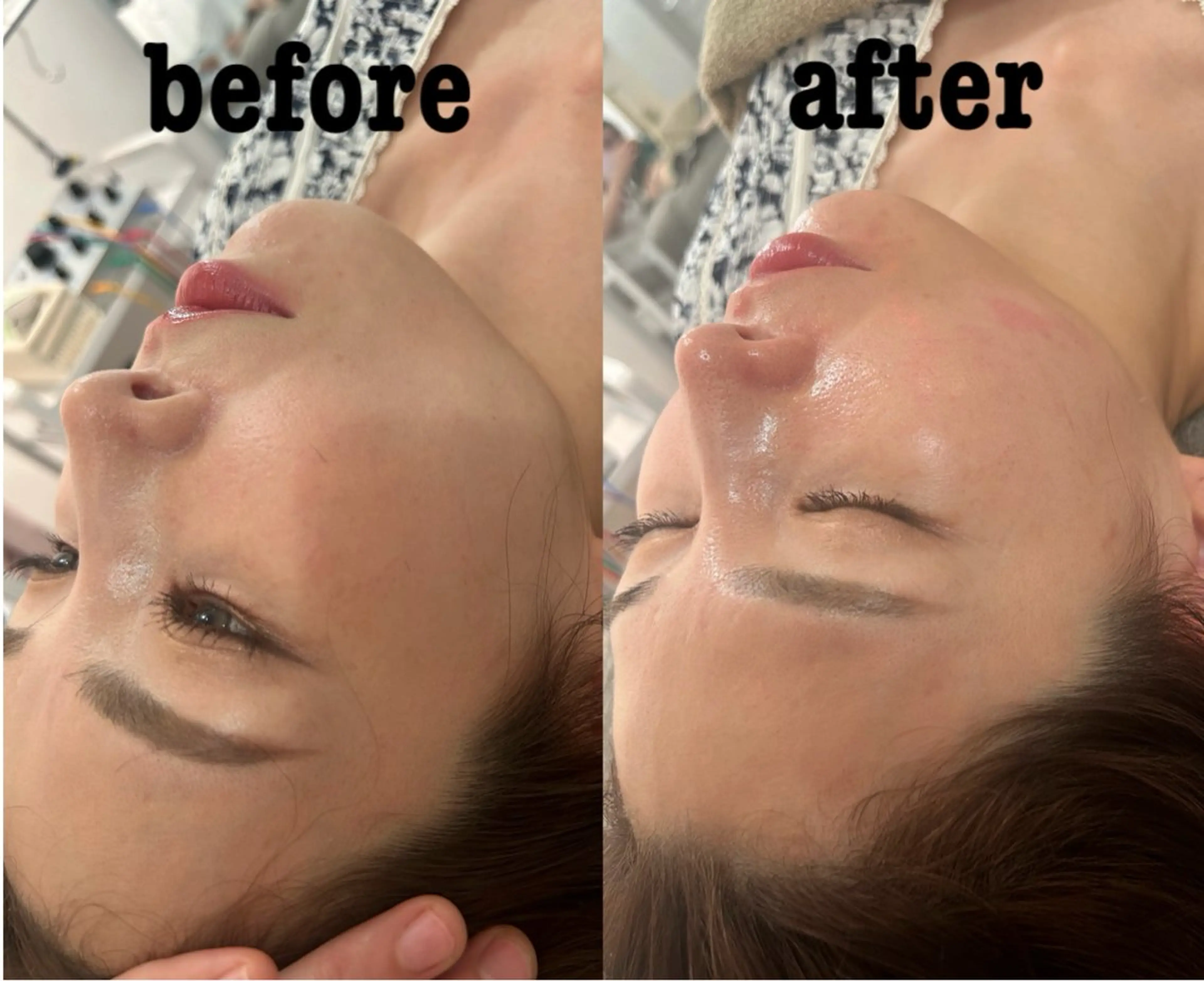 美容鍼灸サロン mahoroba院長のエステ・リラクイメージ