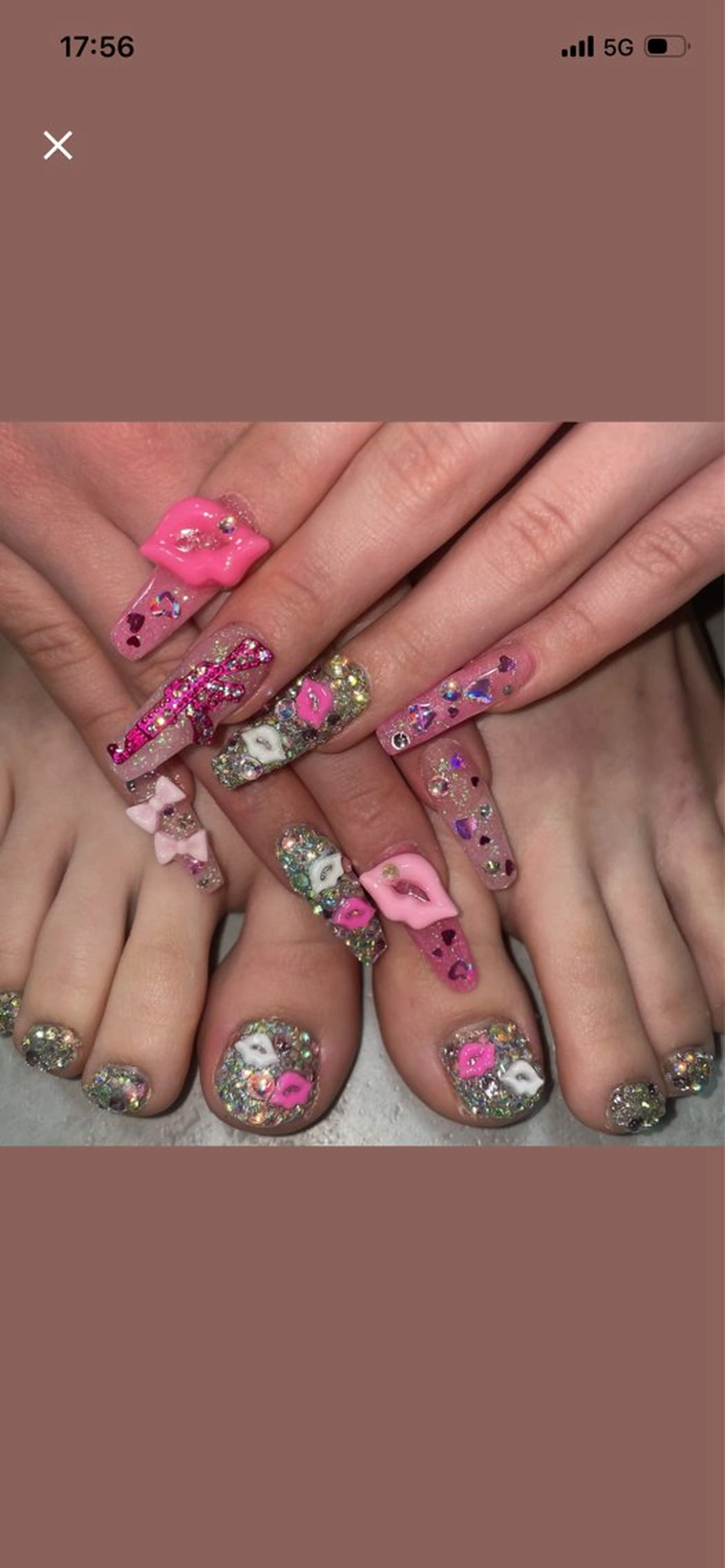 練習モデル ハンド&フットセットの写真