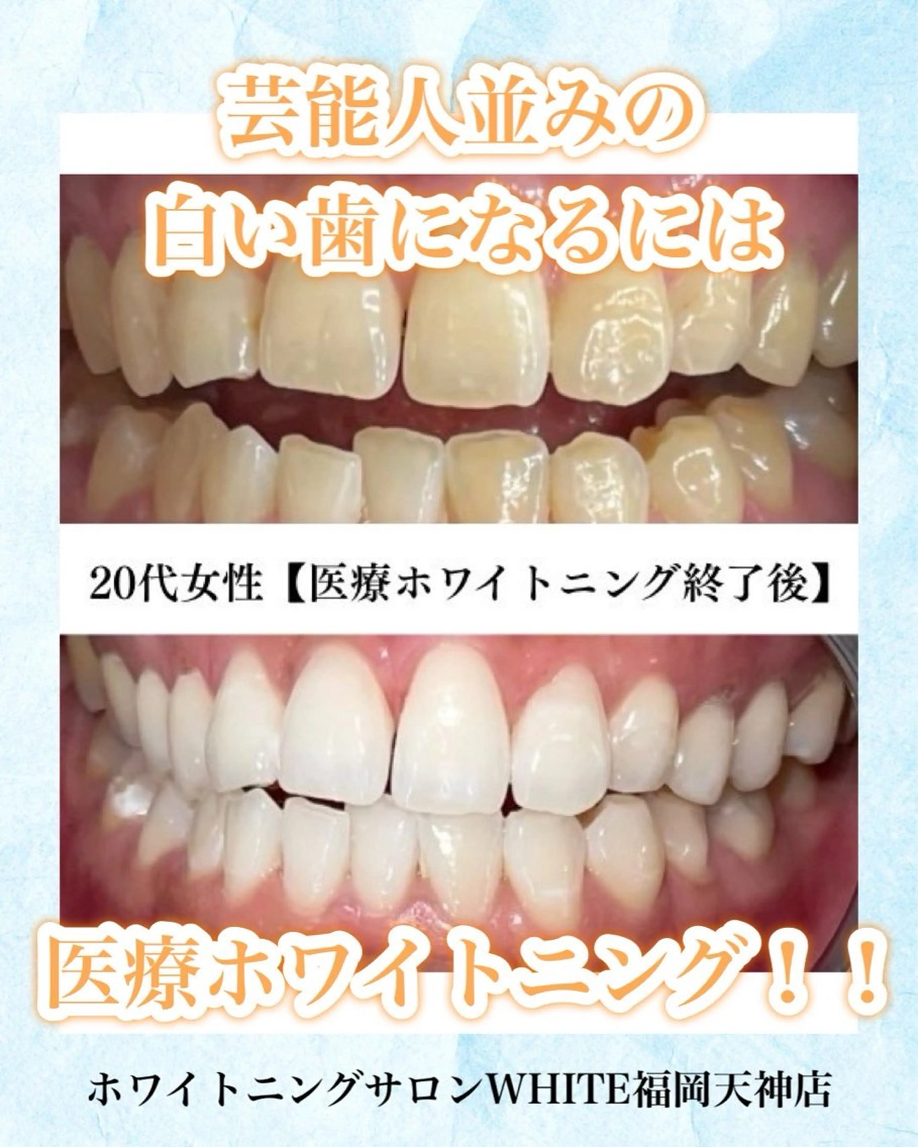 メンズ エステ リラク ホワイトニング専門店 WHITE天神店のエステ・リラクイメージ