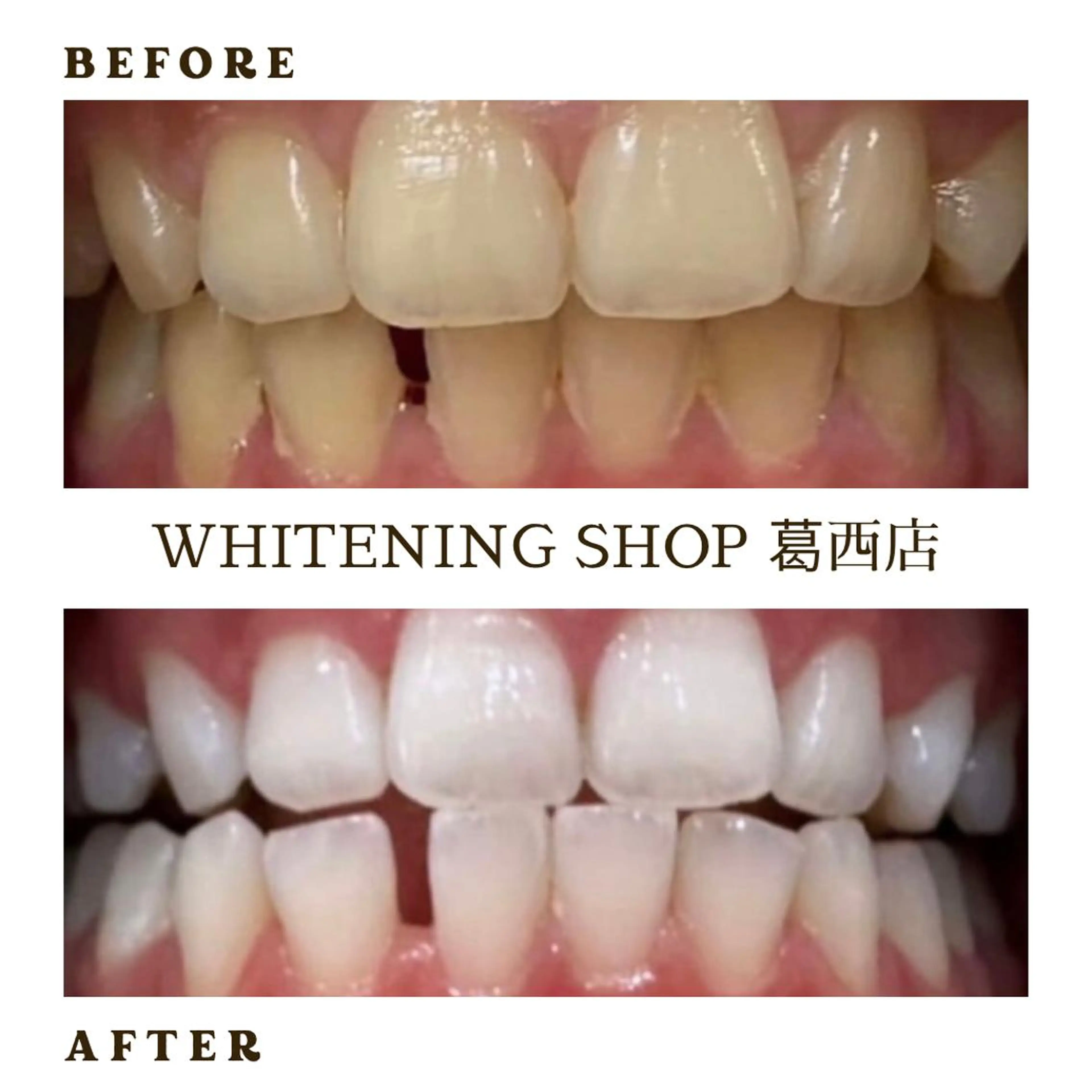 メンズ その他 ホワイトニング ショップ葛西店のその他イメージ