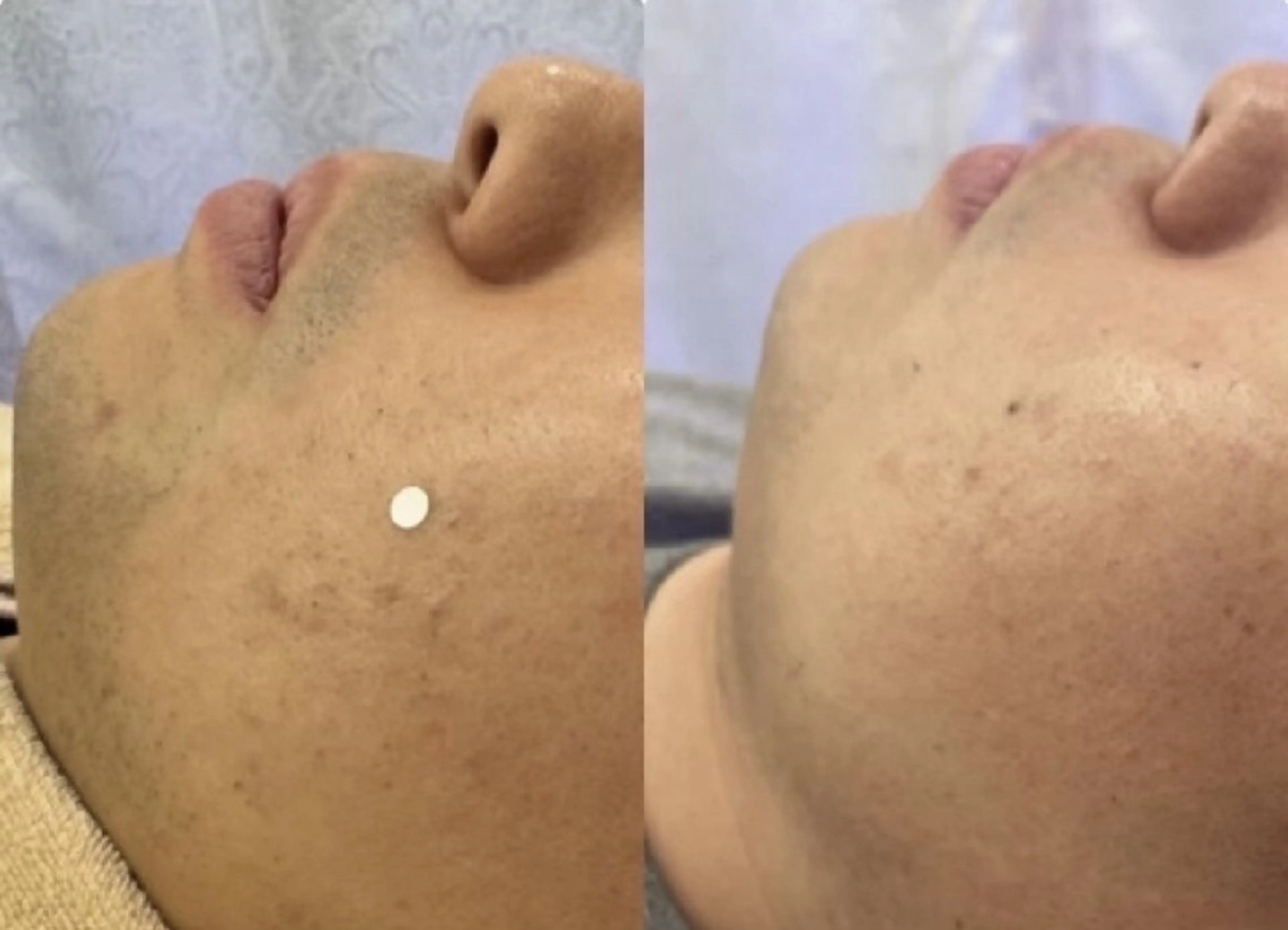 メンズ まつげパーマ×眉毛×脱毛　Cerise Lala所属・まつげパーマ眉毛脱毛 スリーズララ大船店のエステ・リラクイメージ