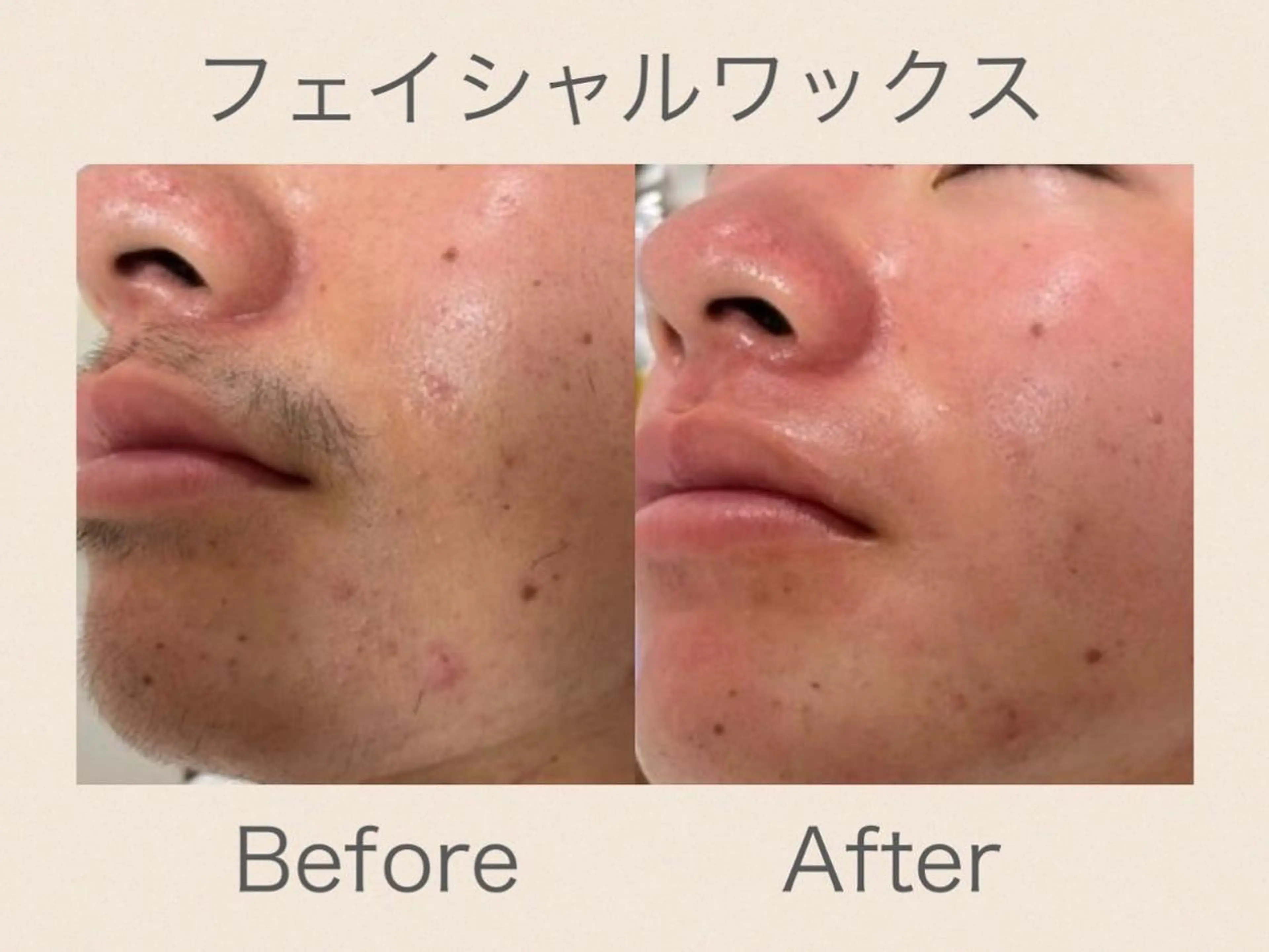 メンズ 脱毛 emi ...の眉毛・アイブロウイメージ