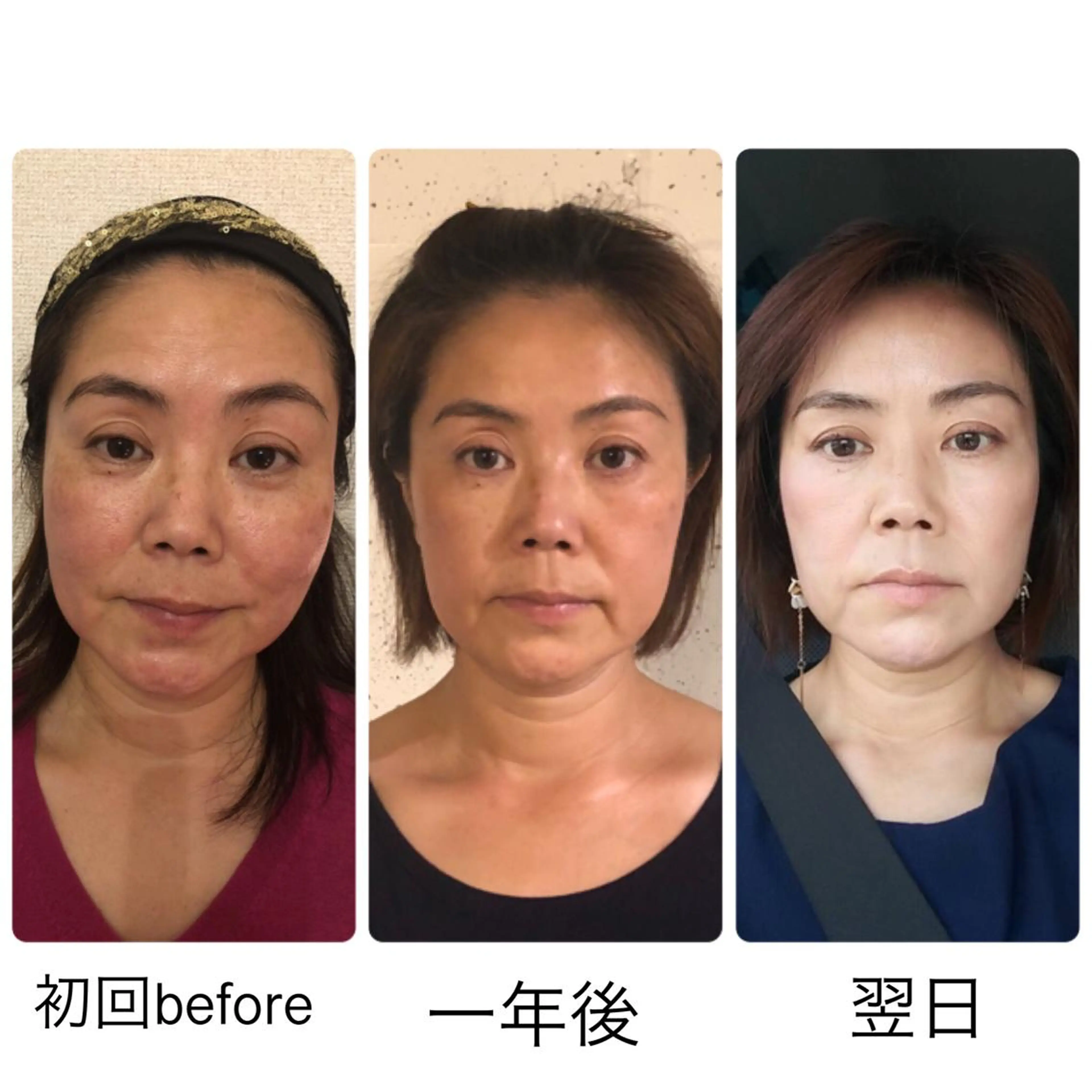 ショート カラー ネイル マツエク・マツパ 小顔矯正専門サロンジュマリ所属・町田 淳子のエステ・リラクイメージ