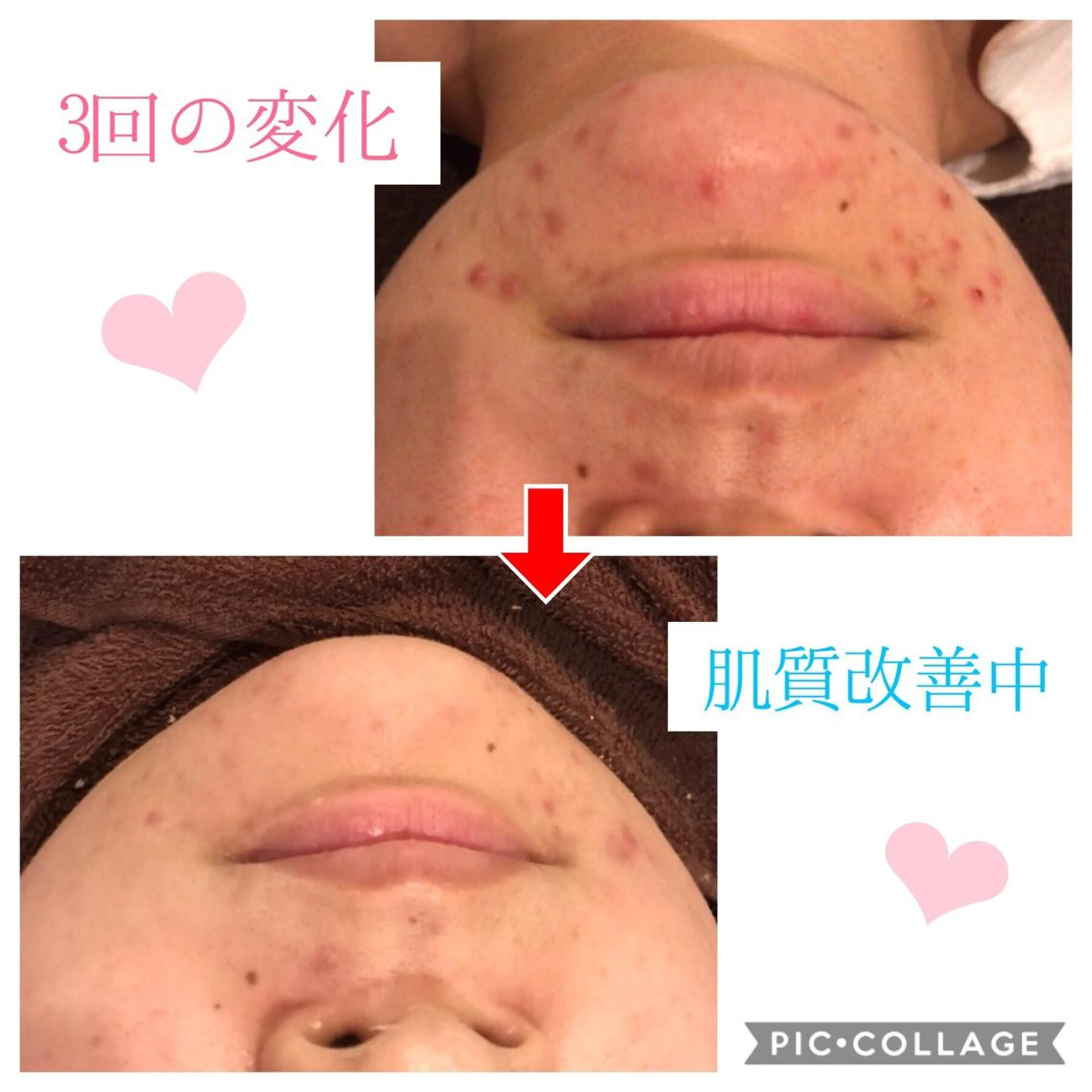 セミロング カラー パーマ ヘアアレンジ メンズ キッズ ネイル マツエク・マツパ 四つ星サロン🎖 腸＆ニキビケアに特化のエステ・リラクイメージ