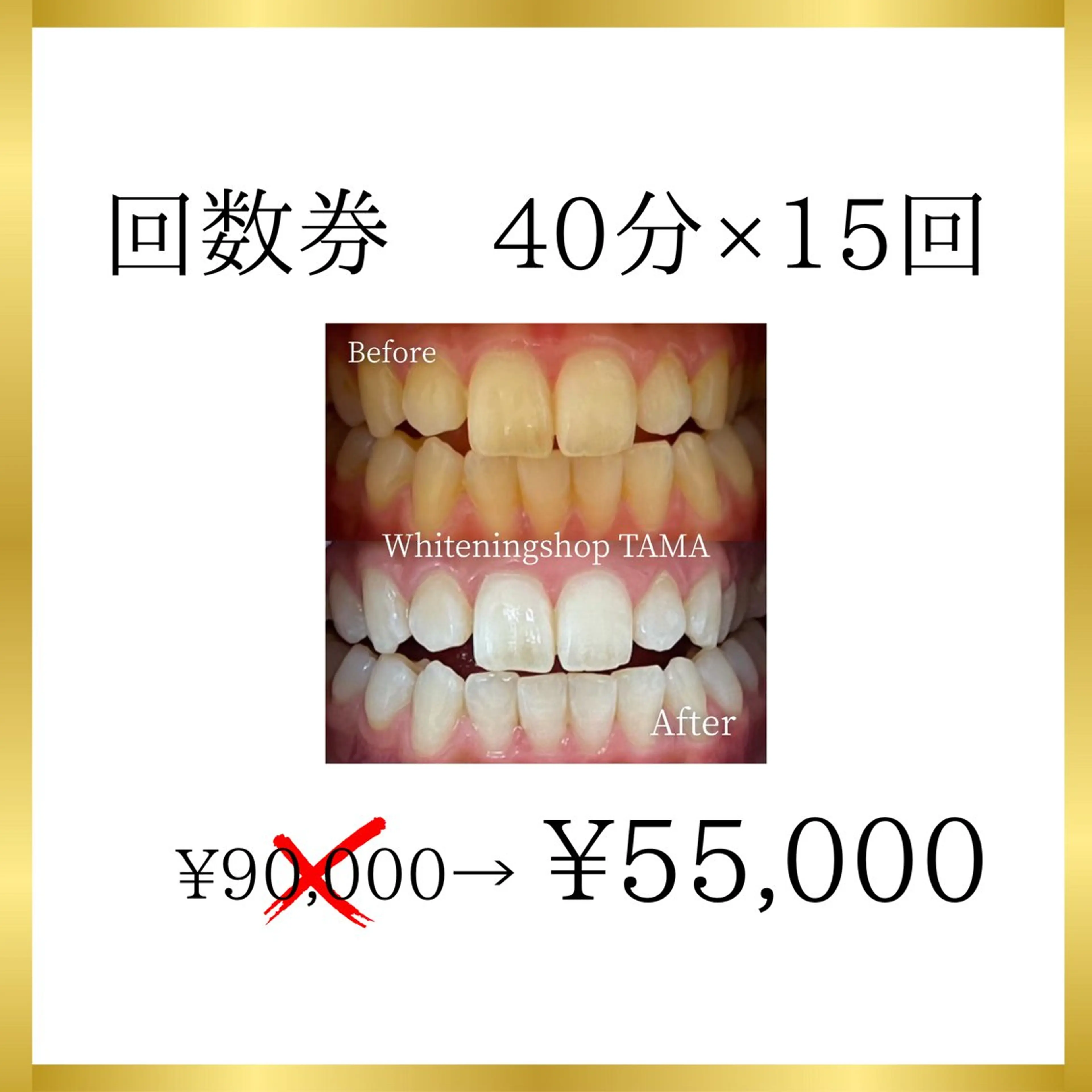 メンズ キッズ ホワイトニング ショップ多摩店のその他イメージ