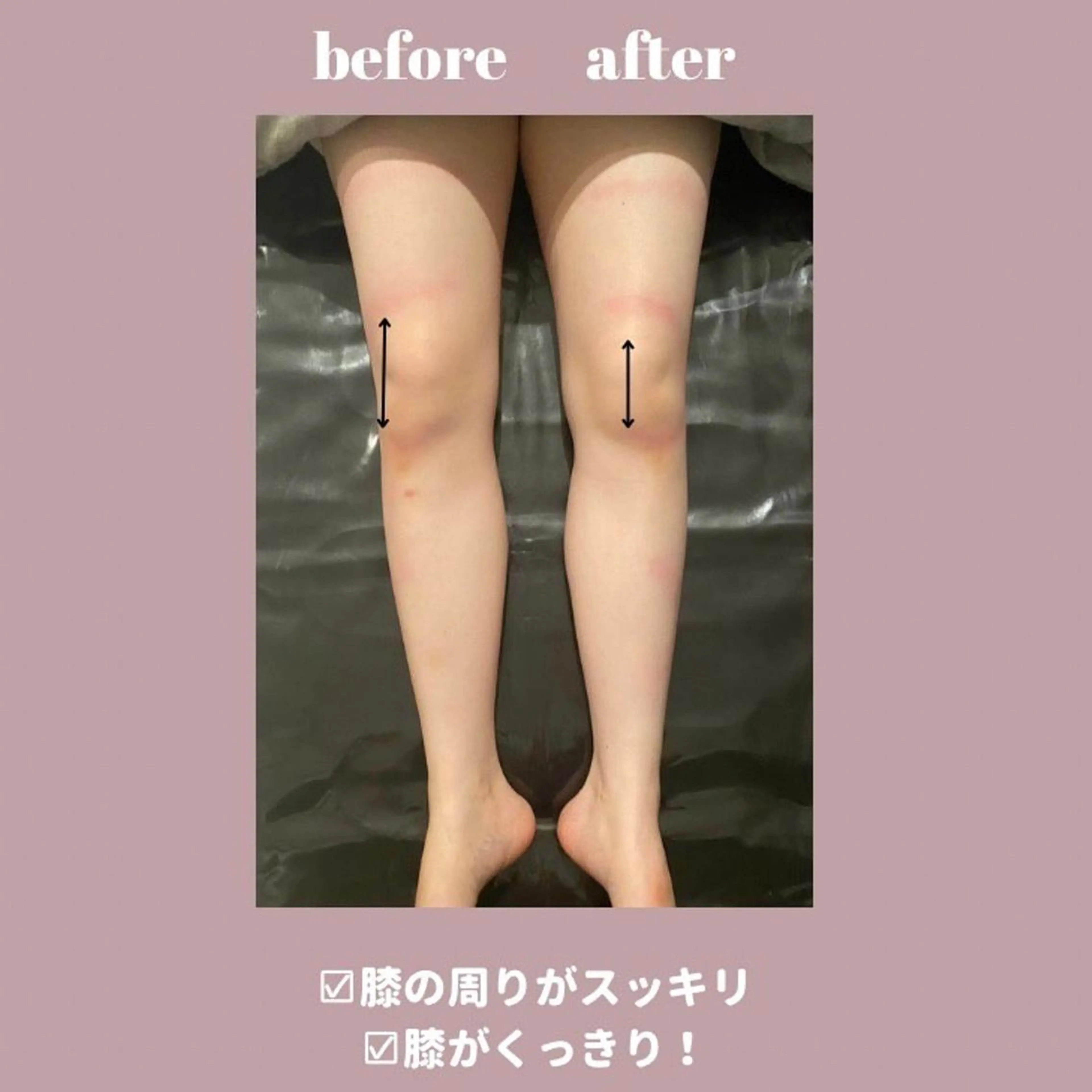 コルギ/全身リンパ mimo.saoriのエステ・リラクイメージ