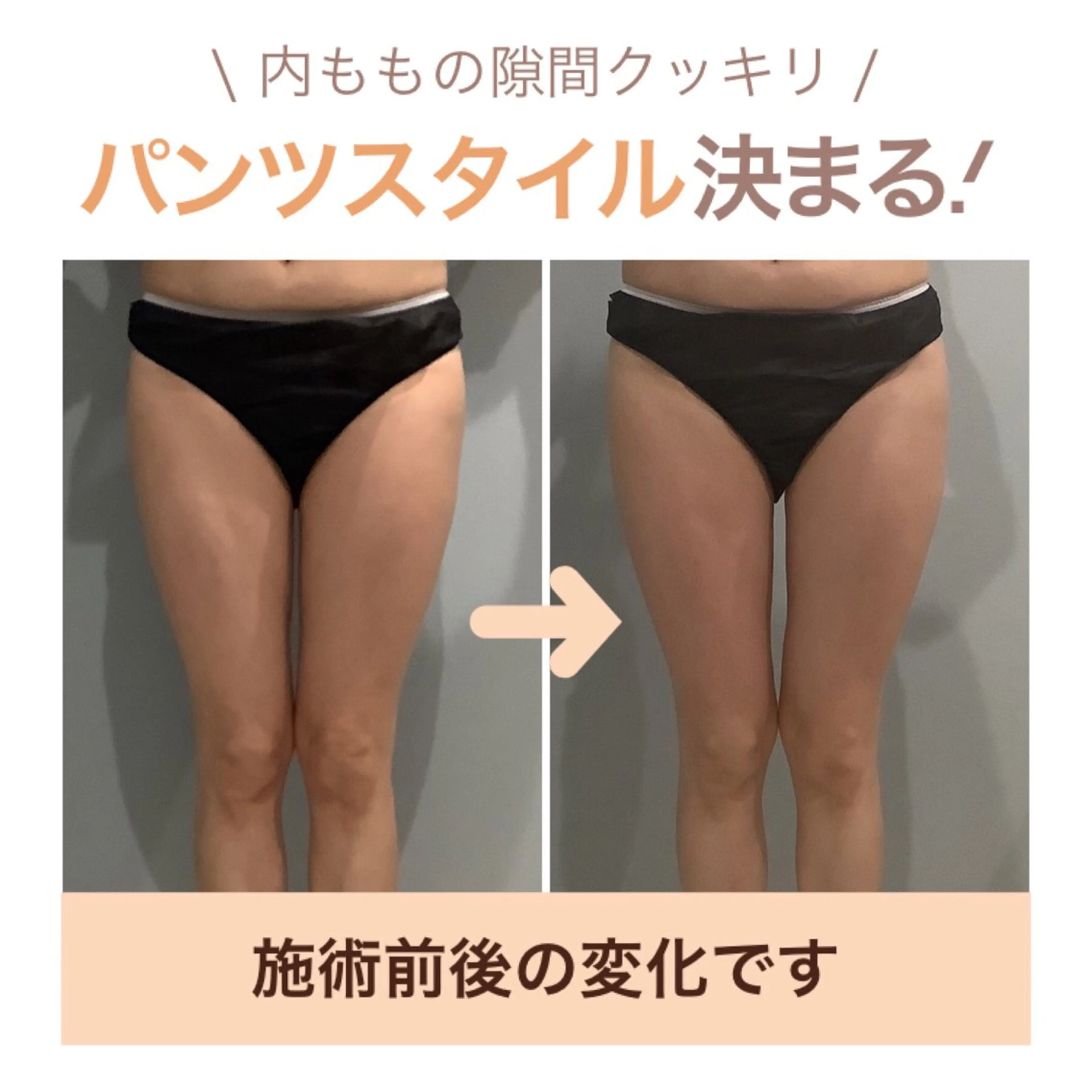 エステ エステサロン JURISのエステ・リラクイメージ