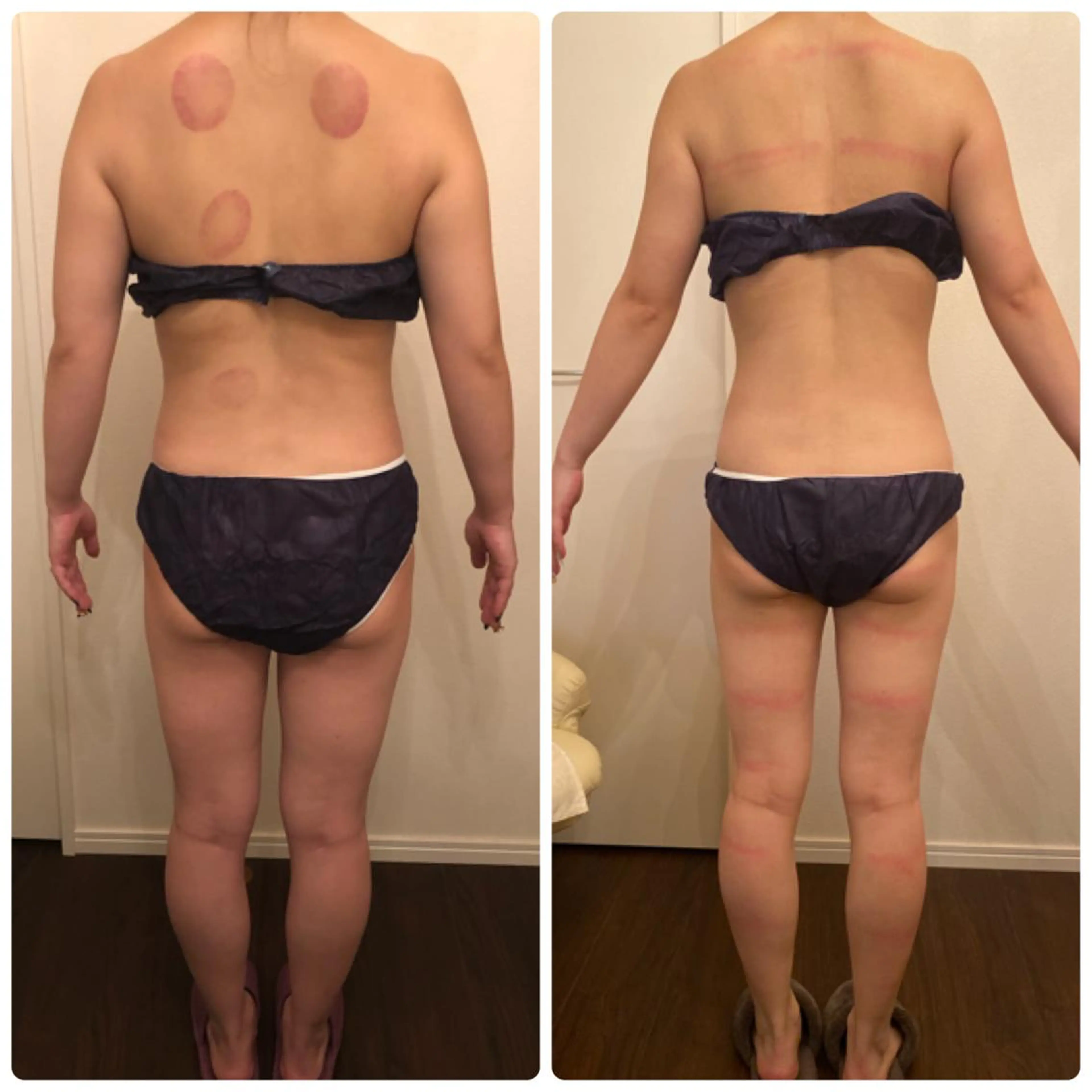 FLEUR大阪・整体 ・ハイフ・痩身・小顔のエステ・リラクイメージ