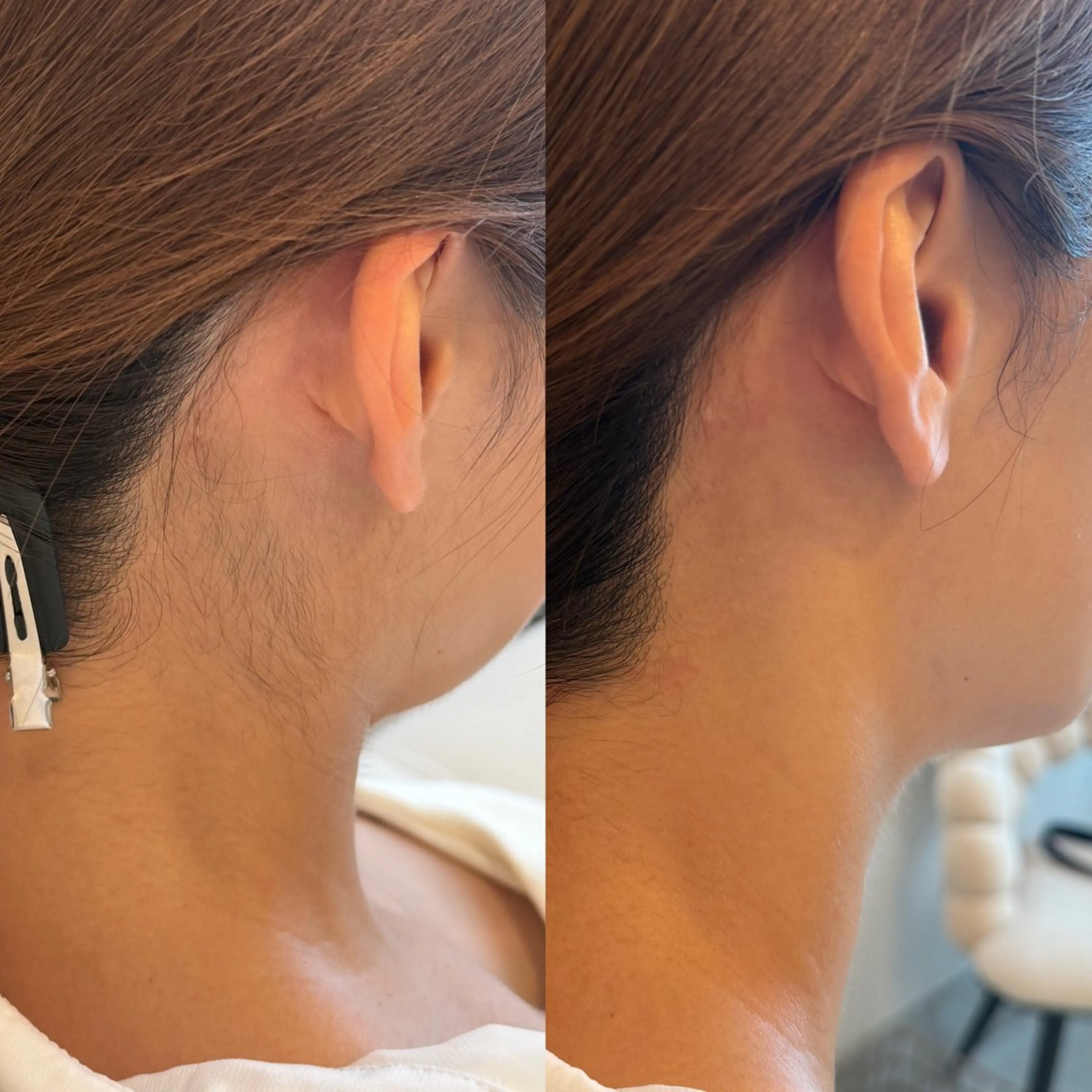 待望のセットメニュー🖤眉ワックス＋うなじワックスの写真