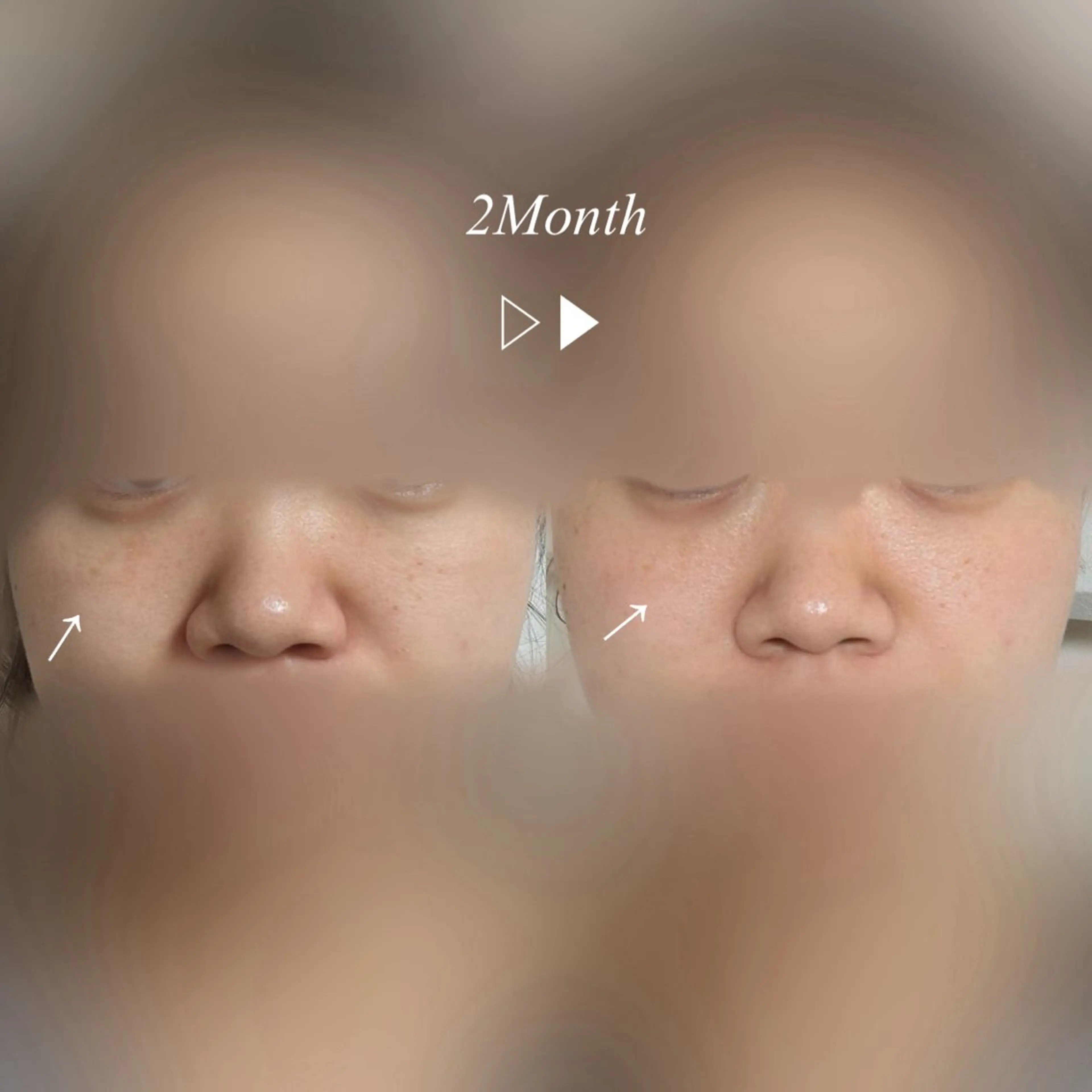 肌質改善サロン🌕 ⠀【ルーナピエナ】のエステ・リラクイメージ