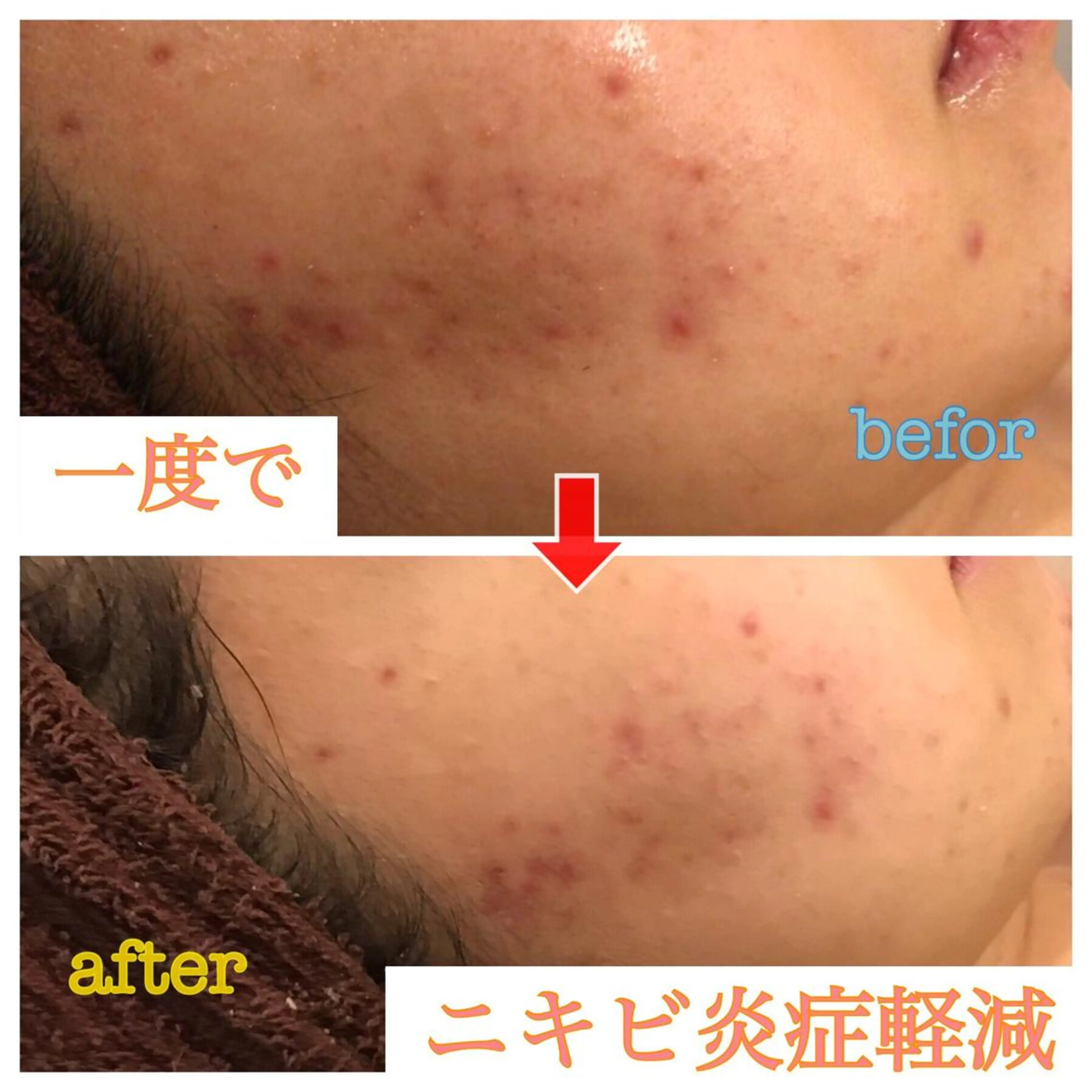 セミロング カラー パーマ ヘアアレンジ メンズ キッズ ネイル マツエク・マツパ 四つ星サロン🎖 腸＆ニキビケアに特化のエステ・リラクイメージ