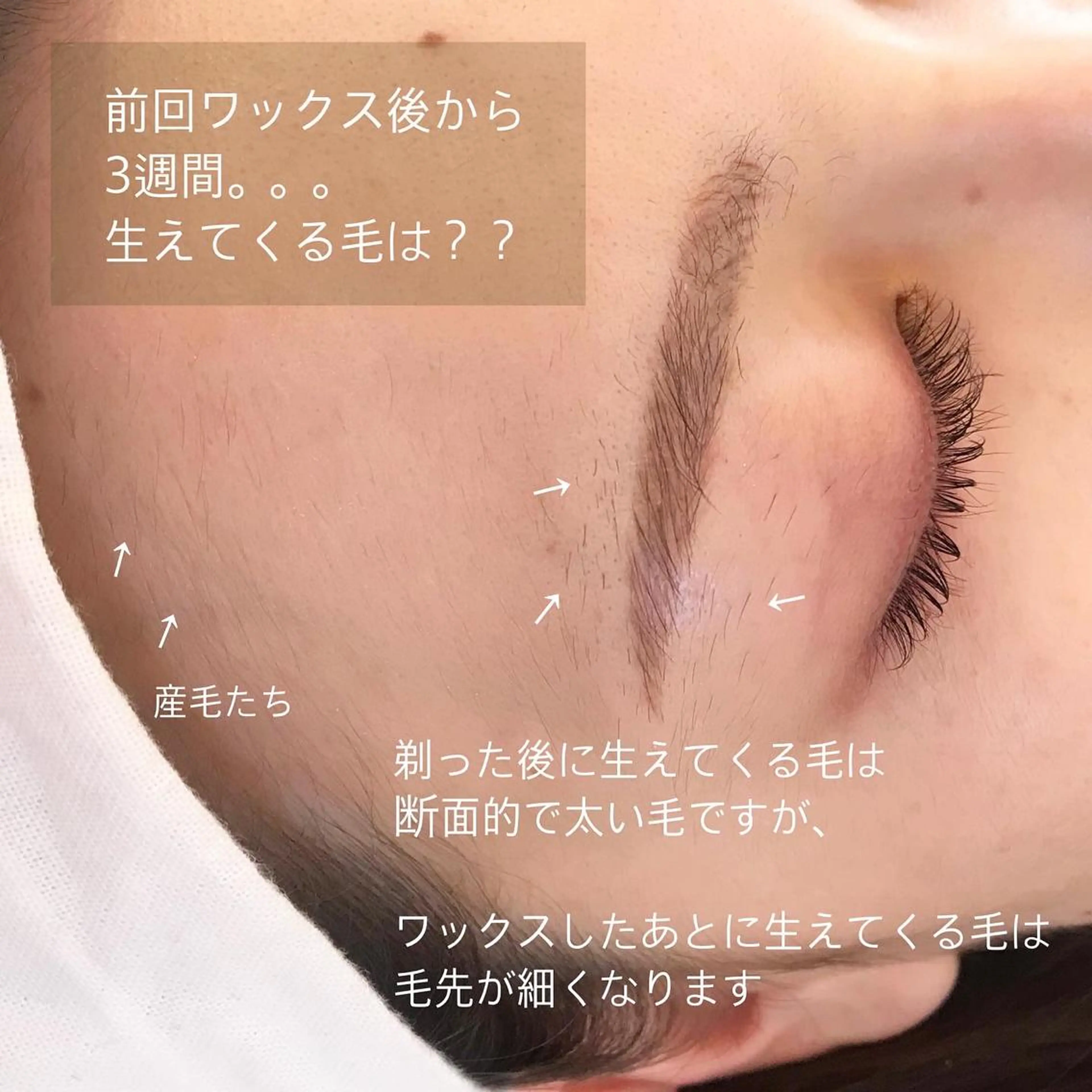 脱毛 ｉ Ayanaのマツエク・マツパデザイン