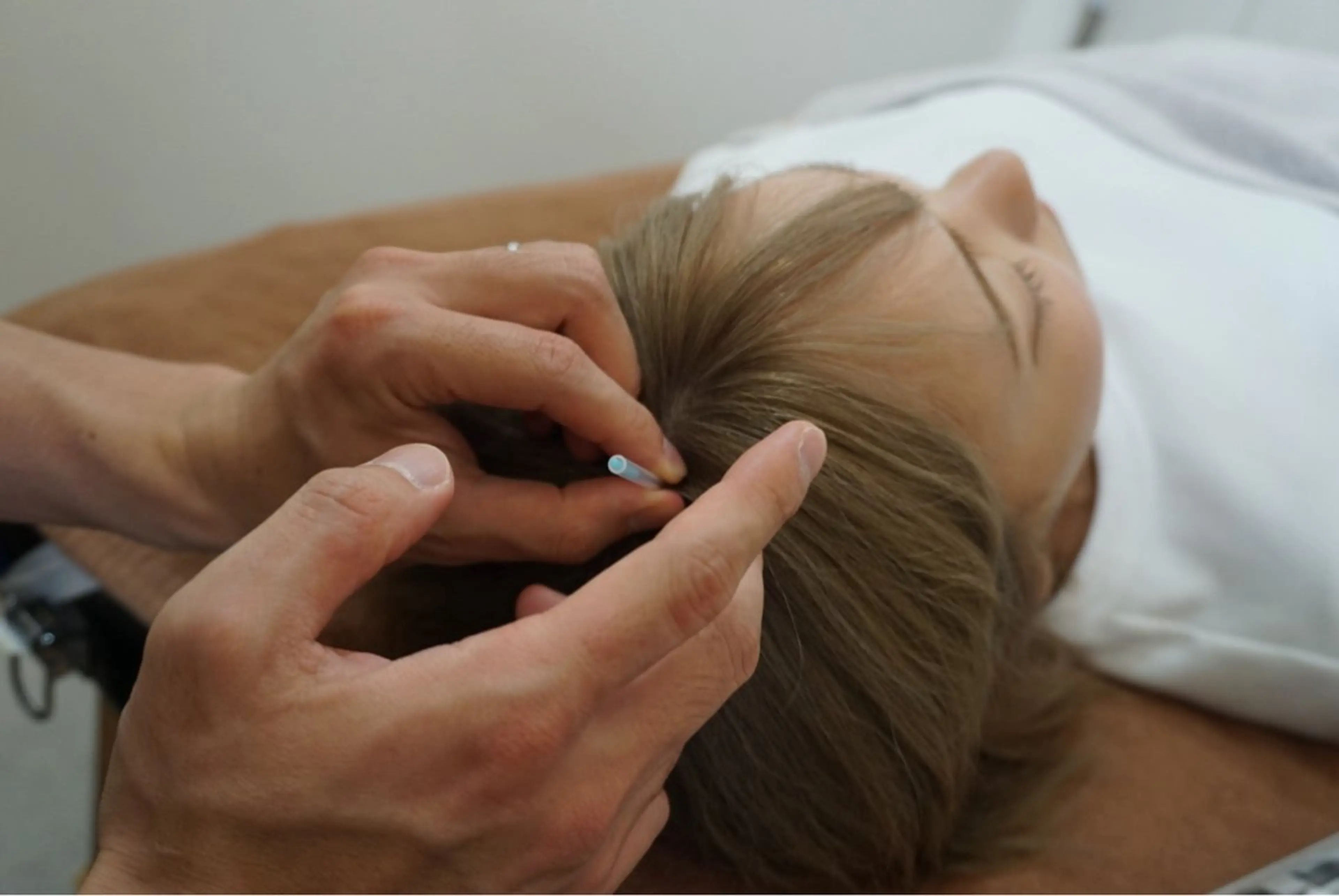 育毛プログラム初回お試しコースの写真