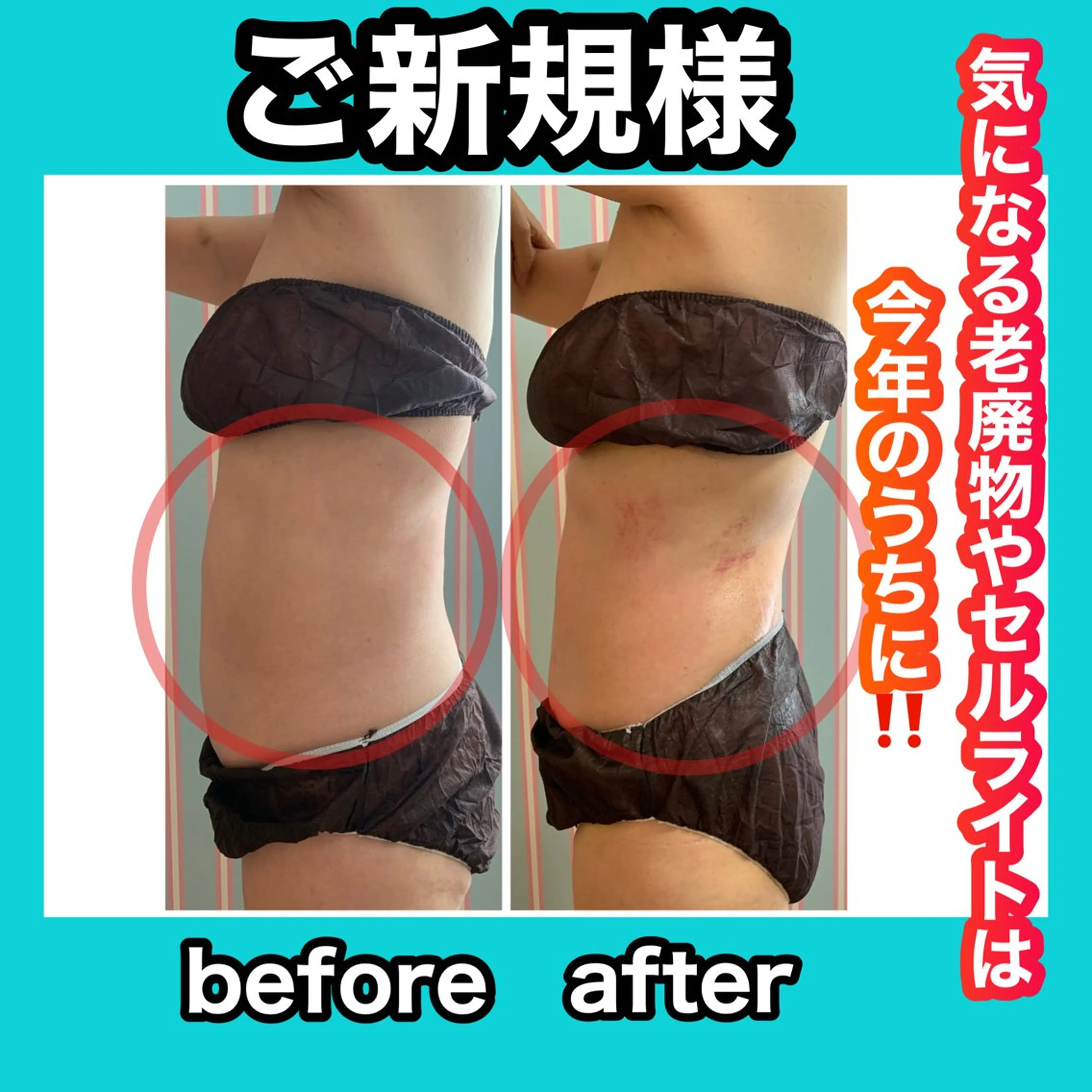 エステ リラク 痩身/脱毛/ネイル HARUKAのエステ・リラクイメージ