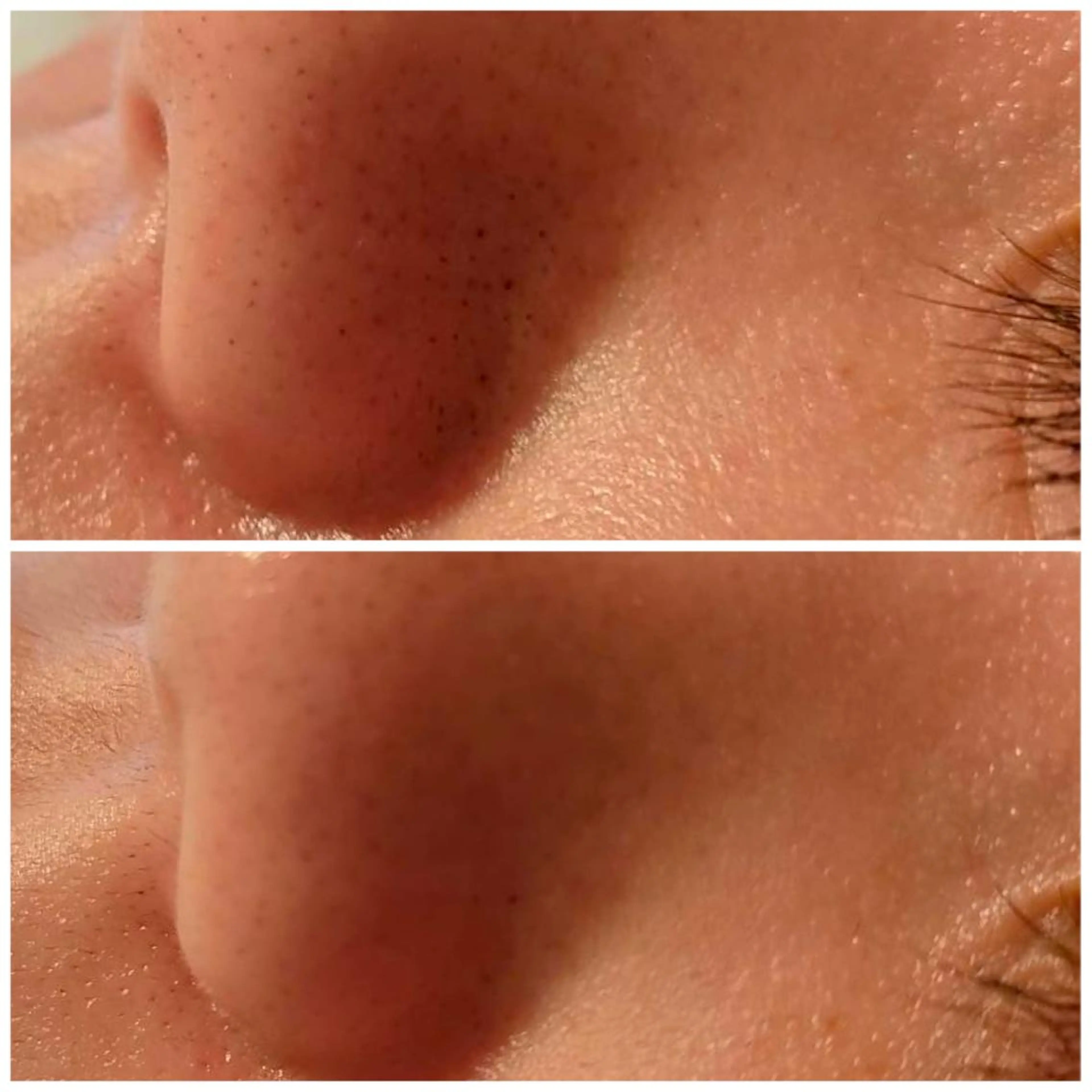 メンズ アイブロウ 眉毛ワックス脱毛 脱毛 B&H所属・頭痛•肩こり専門/ 眉サロンB&H心斎橋のエステ・リラクイメージ