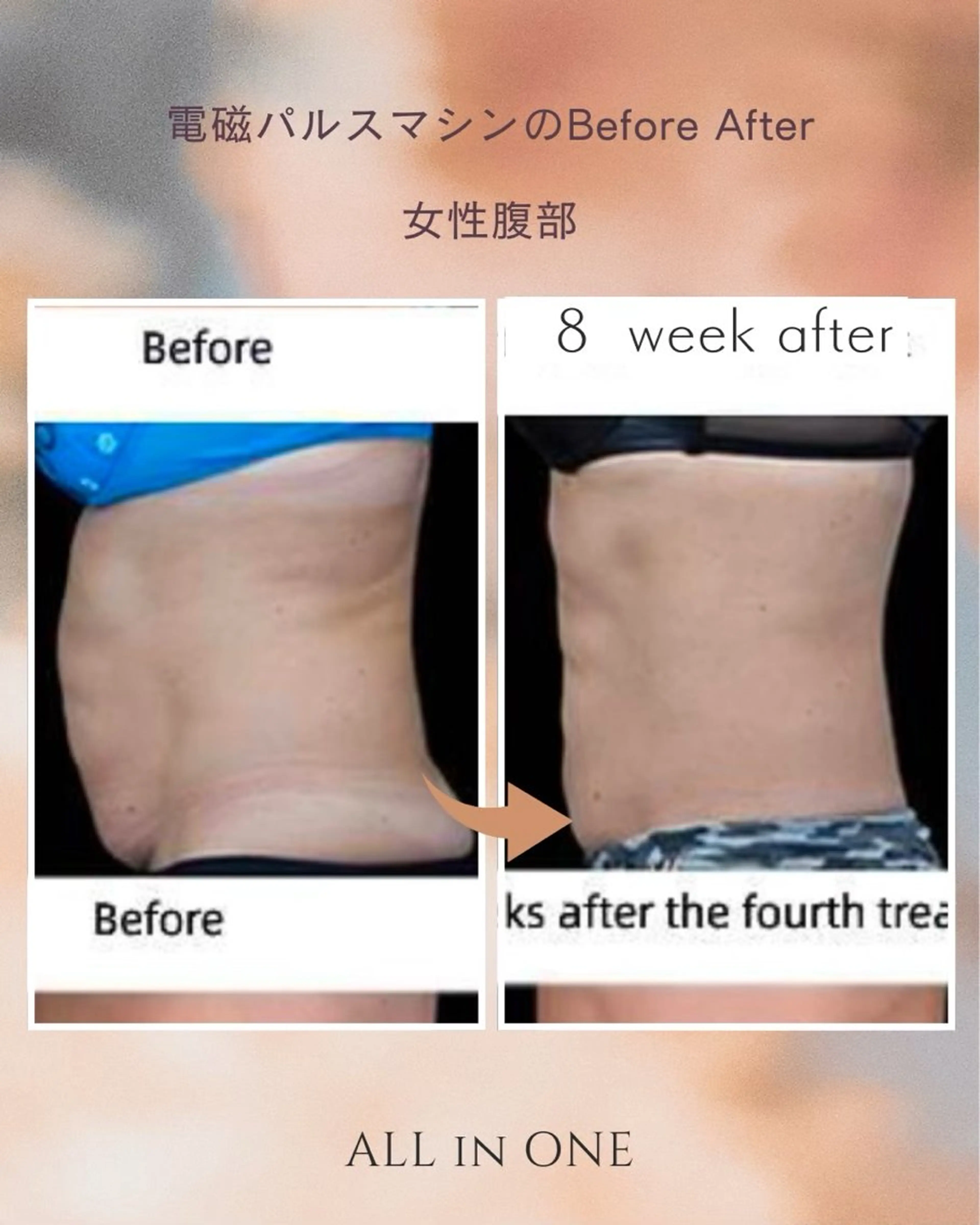 エステ セルフエステ ALL in ONE所属・1組貸切 セルフエステのエステ・リラクイメージ