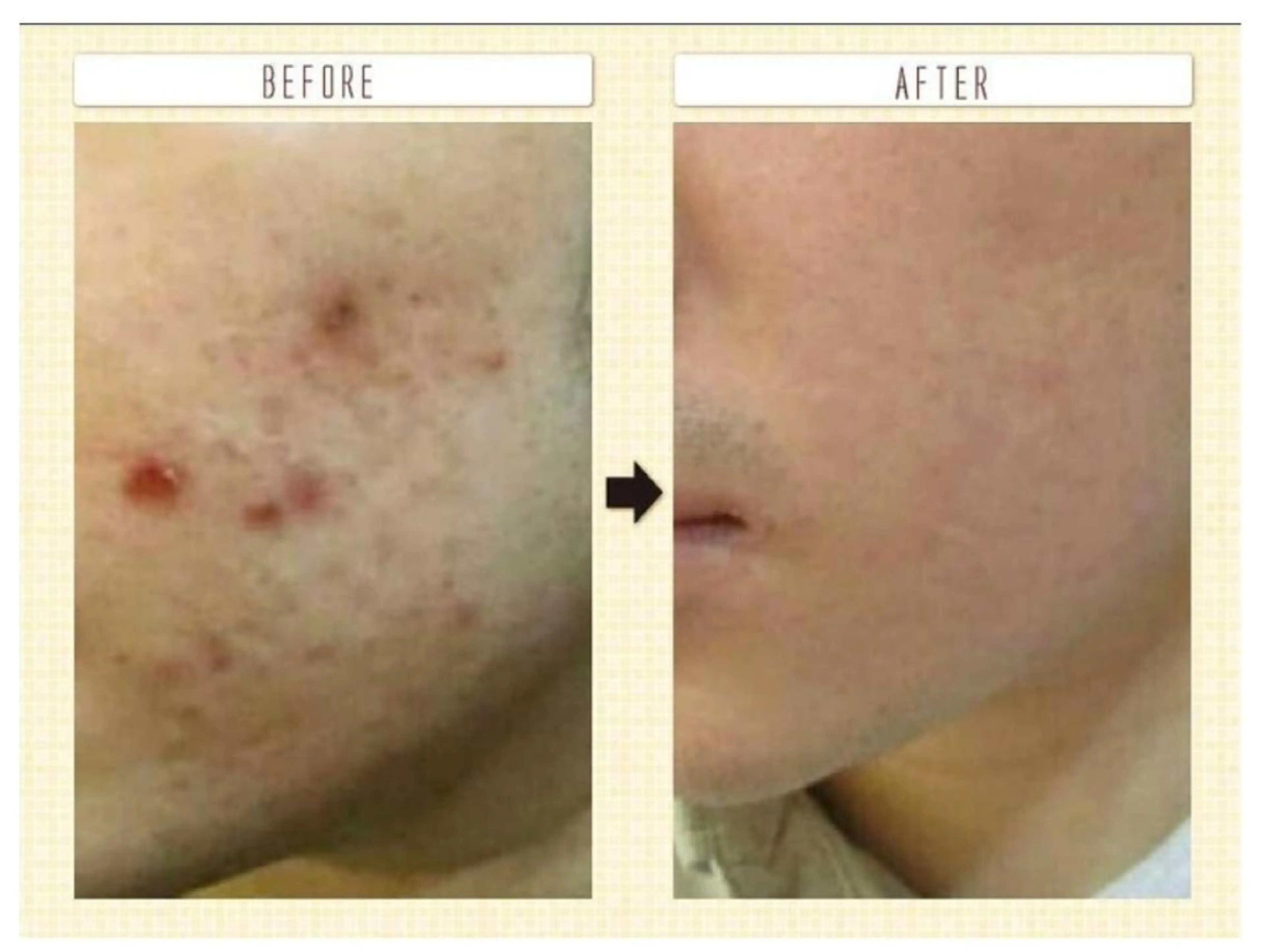 アロハーブ 韓国肌管理のエステ・リラクイメージ