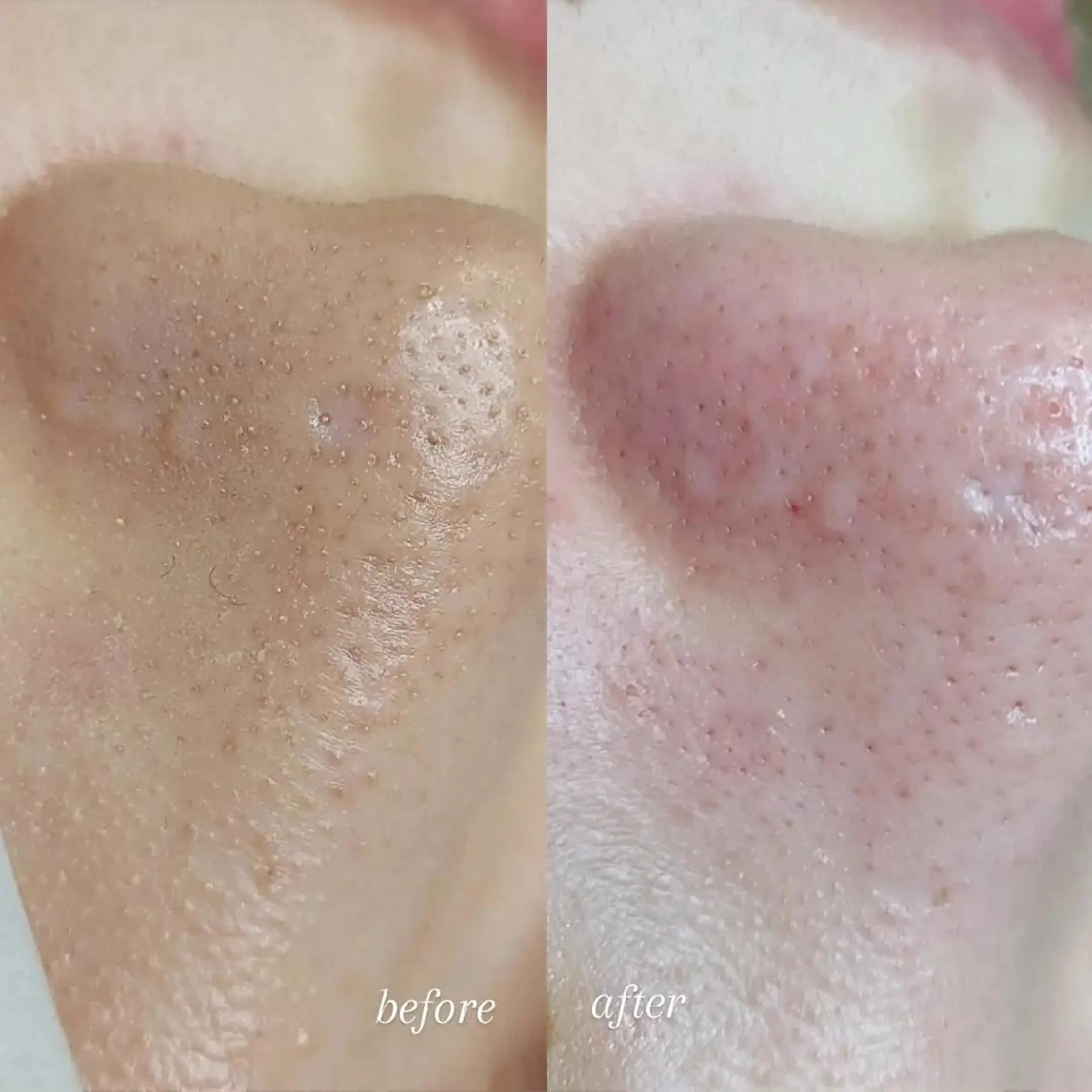 U_la所属・U_la [ウーラ] 片岡の眉毛・アイブロウイメージ