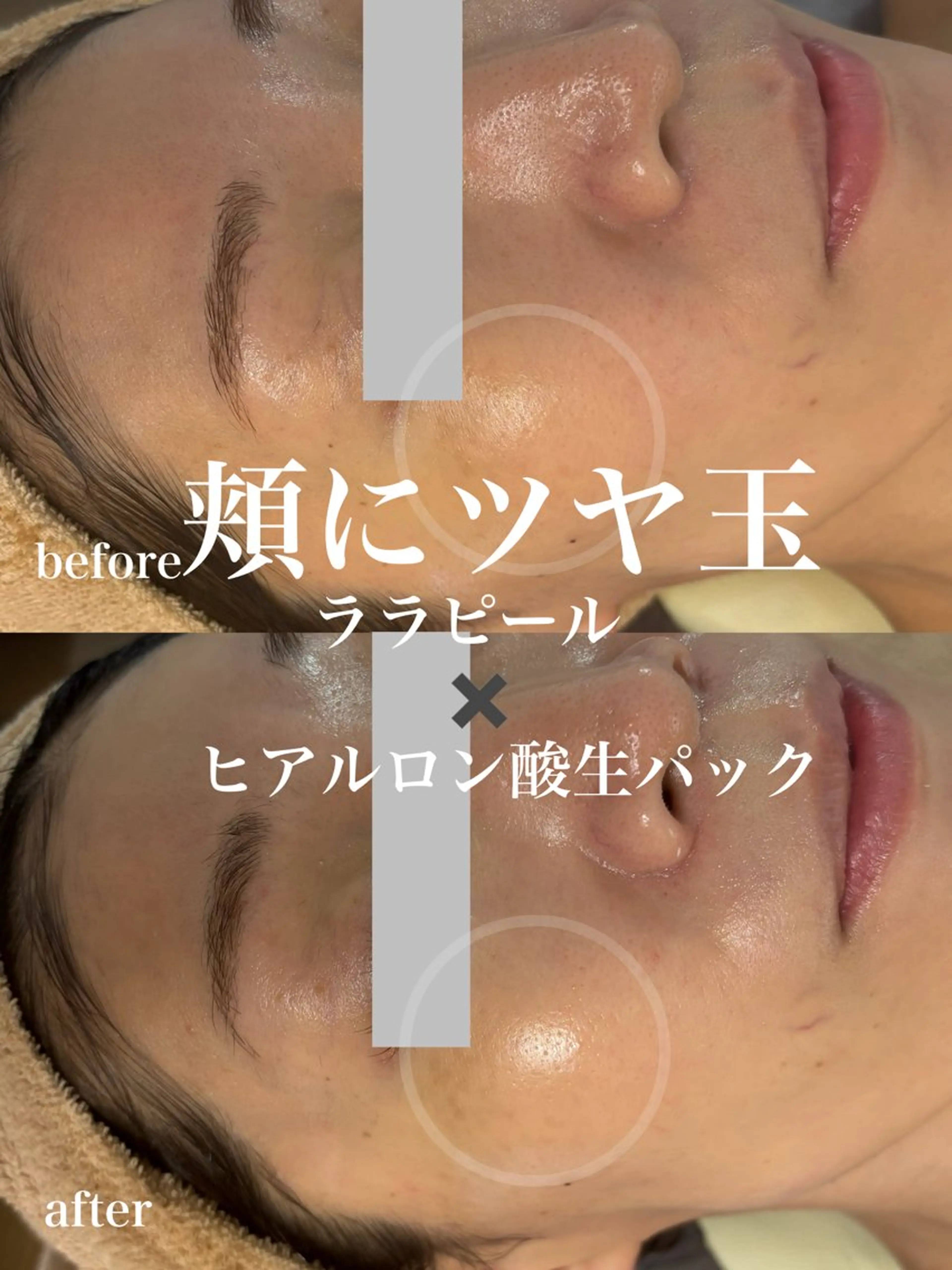 WHITE AQUA 北千住店のエステ・リラクイメージ