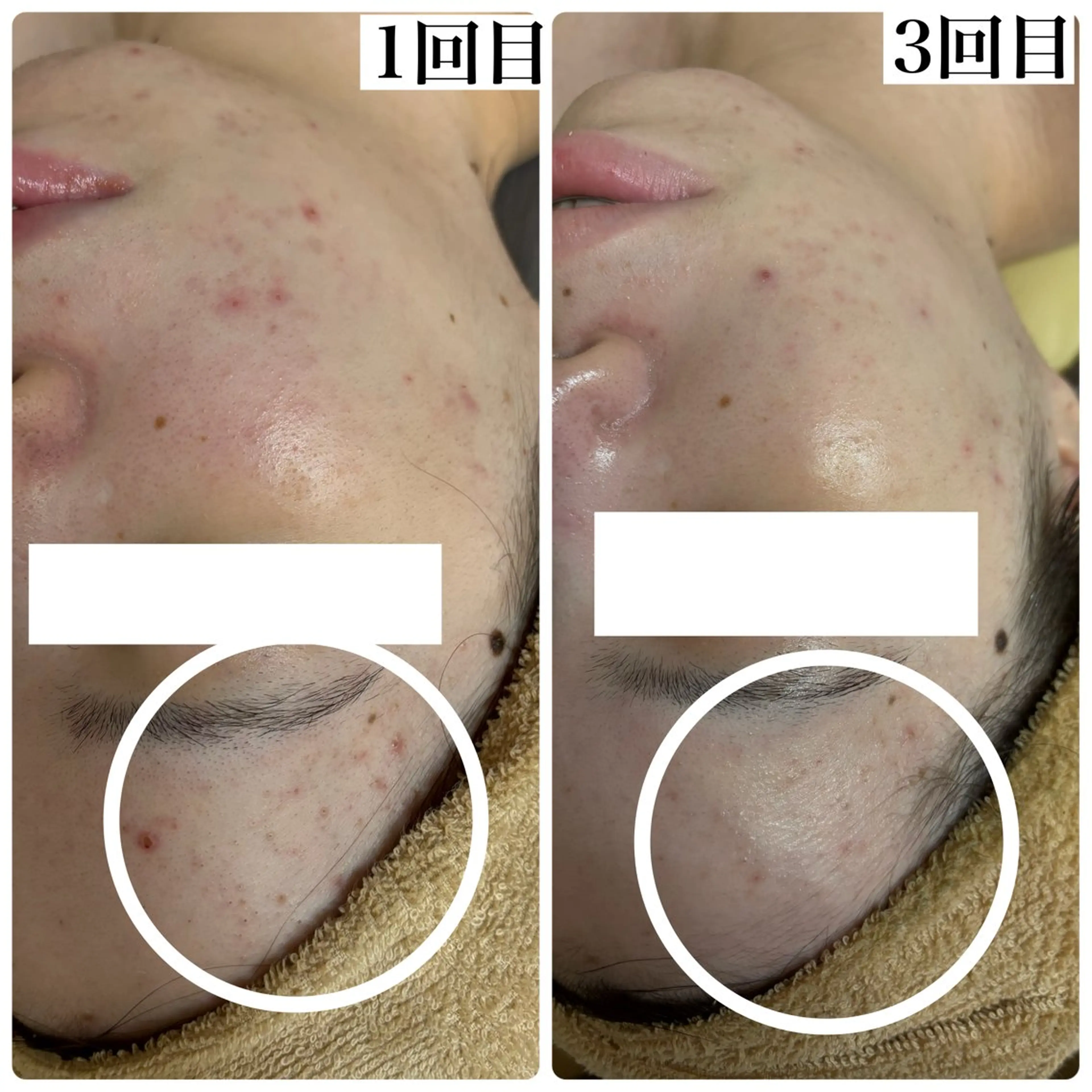 エステ WHITE AQUA 北千住店のエステ・リラクイメージ