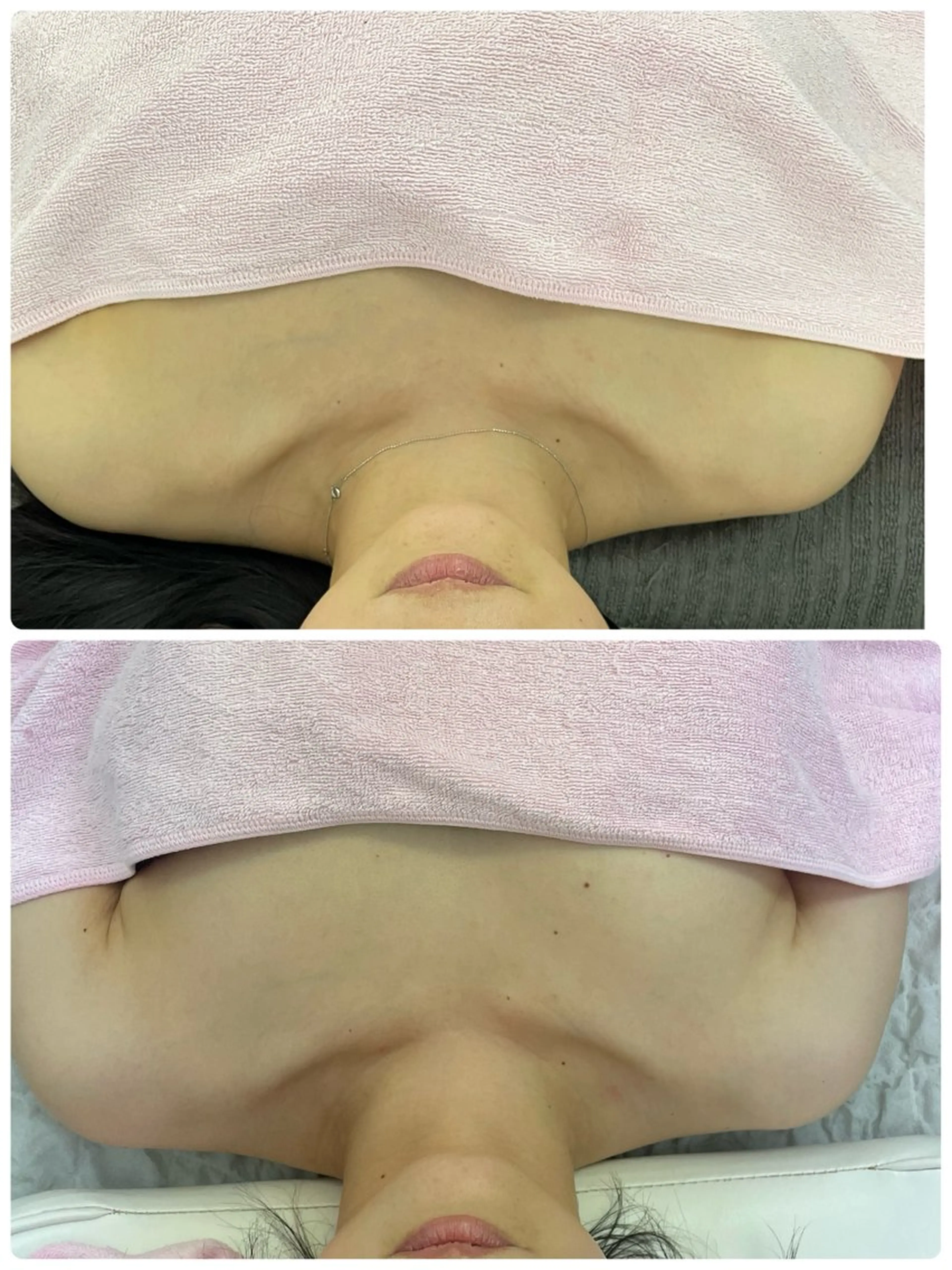 Salon Rion所属・Rion 野々村のエステ・リラクイメージ