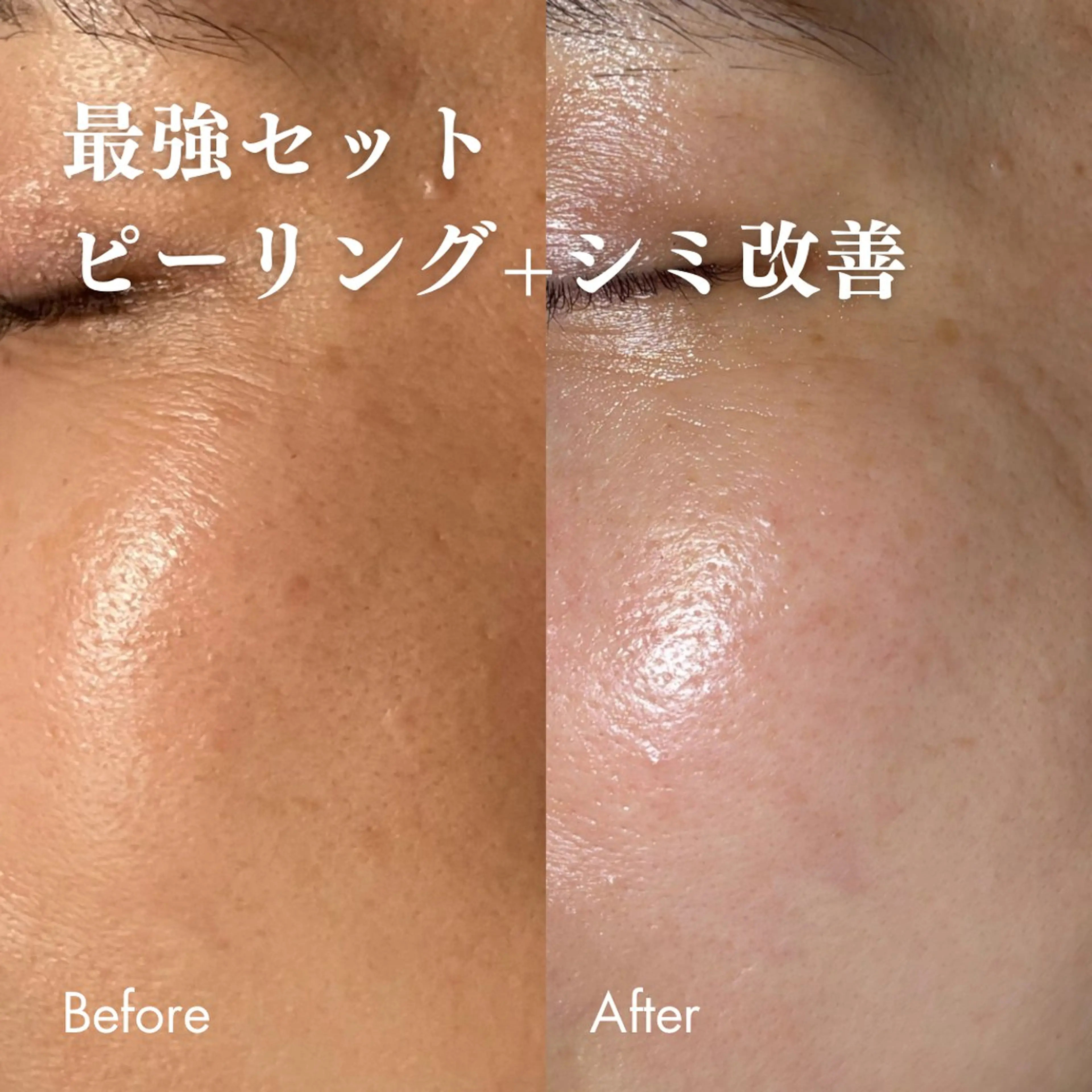 エステ Lassy Yuriの眉毛・アイブロウイメージ