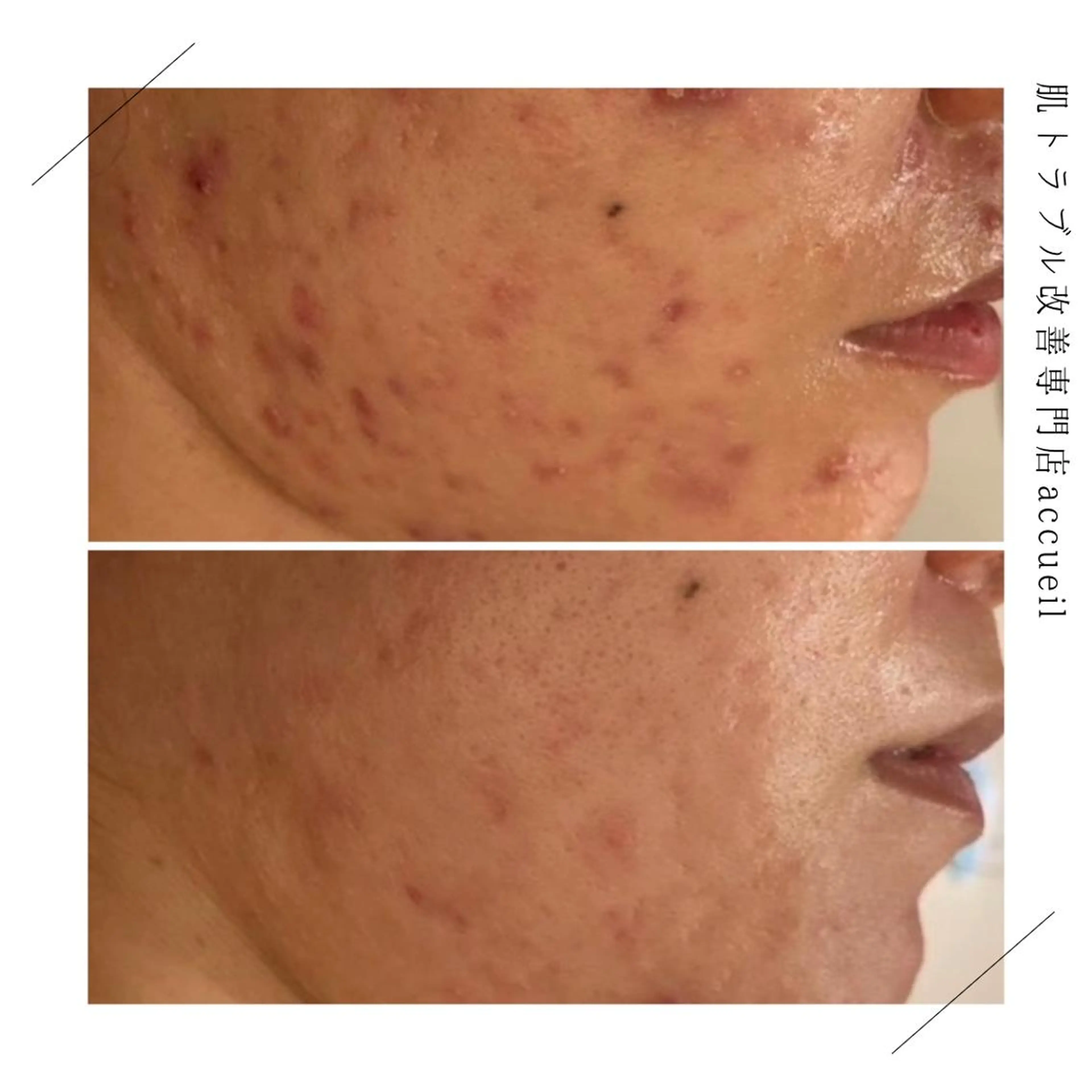 セミロング カラー パーマ ヘアアレンジ メンズ キッズ ネイル マツエク・マツパ アイブロウ 触れたくなる モテ肌へ...❤︎のエステ・リラクイメージ